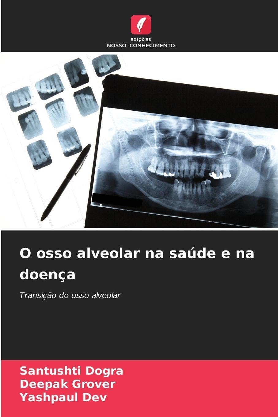 O osso alveolar na saúde e na doença Medicine