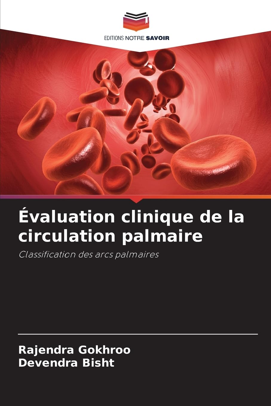 Évaluation clinique de la circulation palmaire Medicine