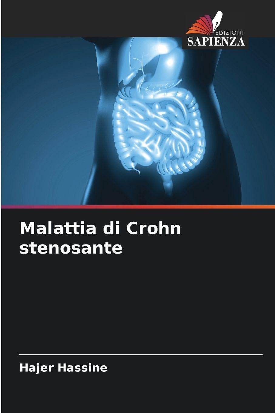 Malattia di Crohn stenosante Medicine