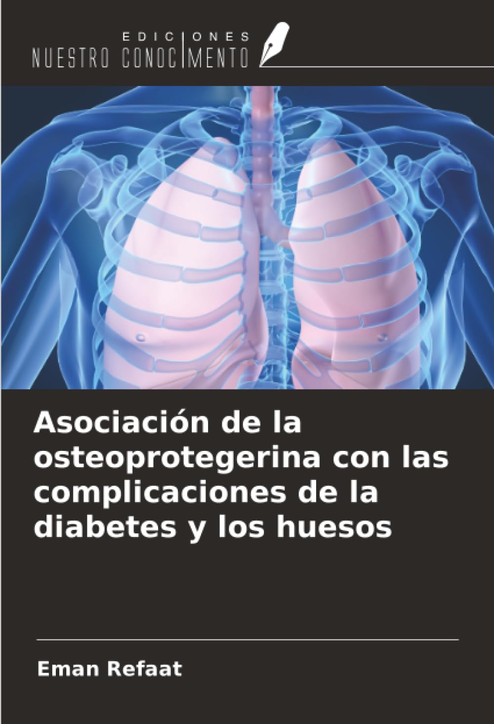 Asociación de la osteoprotegerina con las complicaciones de la diabetes y los huesos Medicine