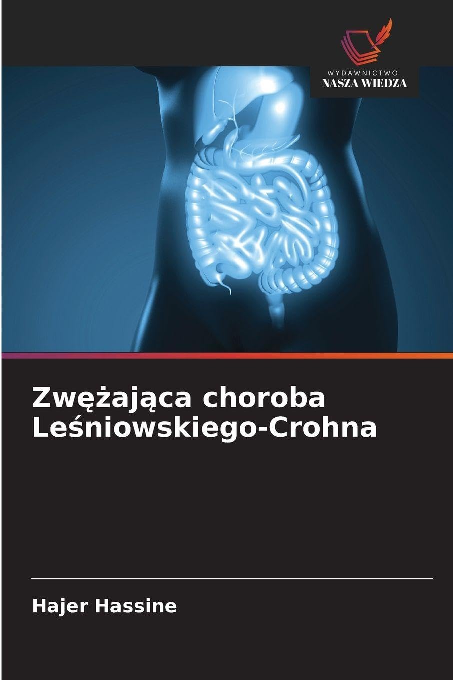 Zw¿¿aj¿ca choroba Le¿niowskiego-Crohna Medicine