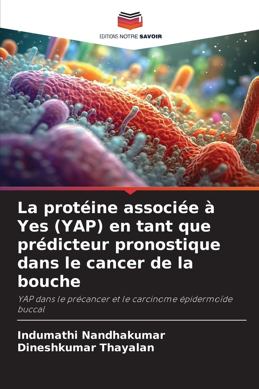 La protéine associée à Yes (YAP) en tant que prédicteur pronostique dans le cancer de la bouche Law