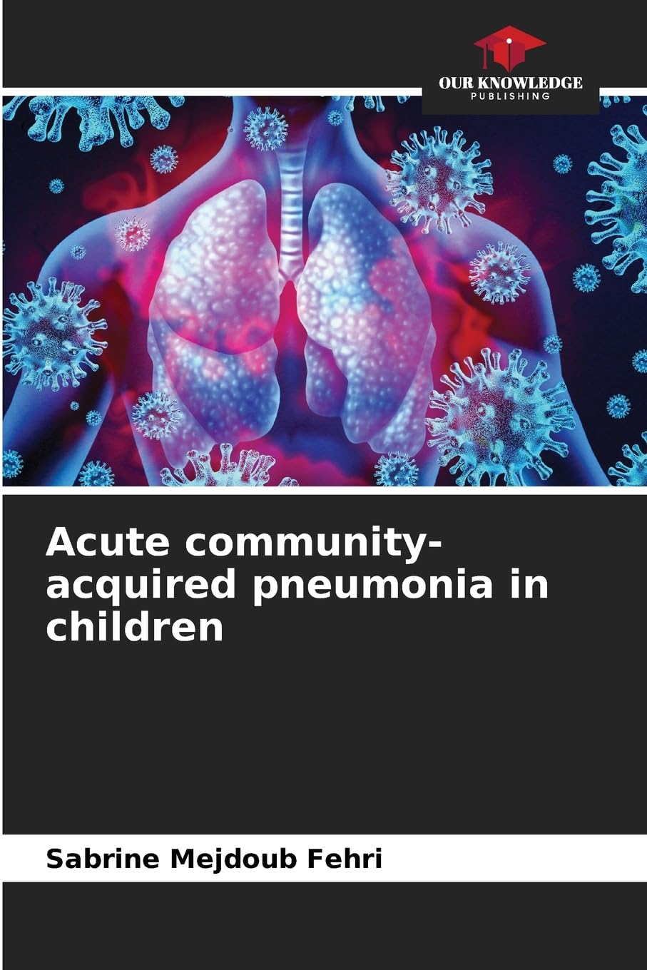 Acute community-acquired pneumonia in children Medicine