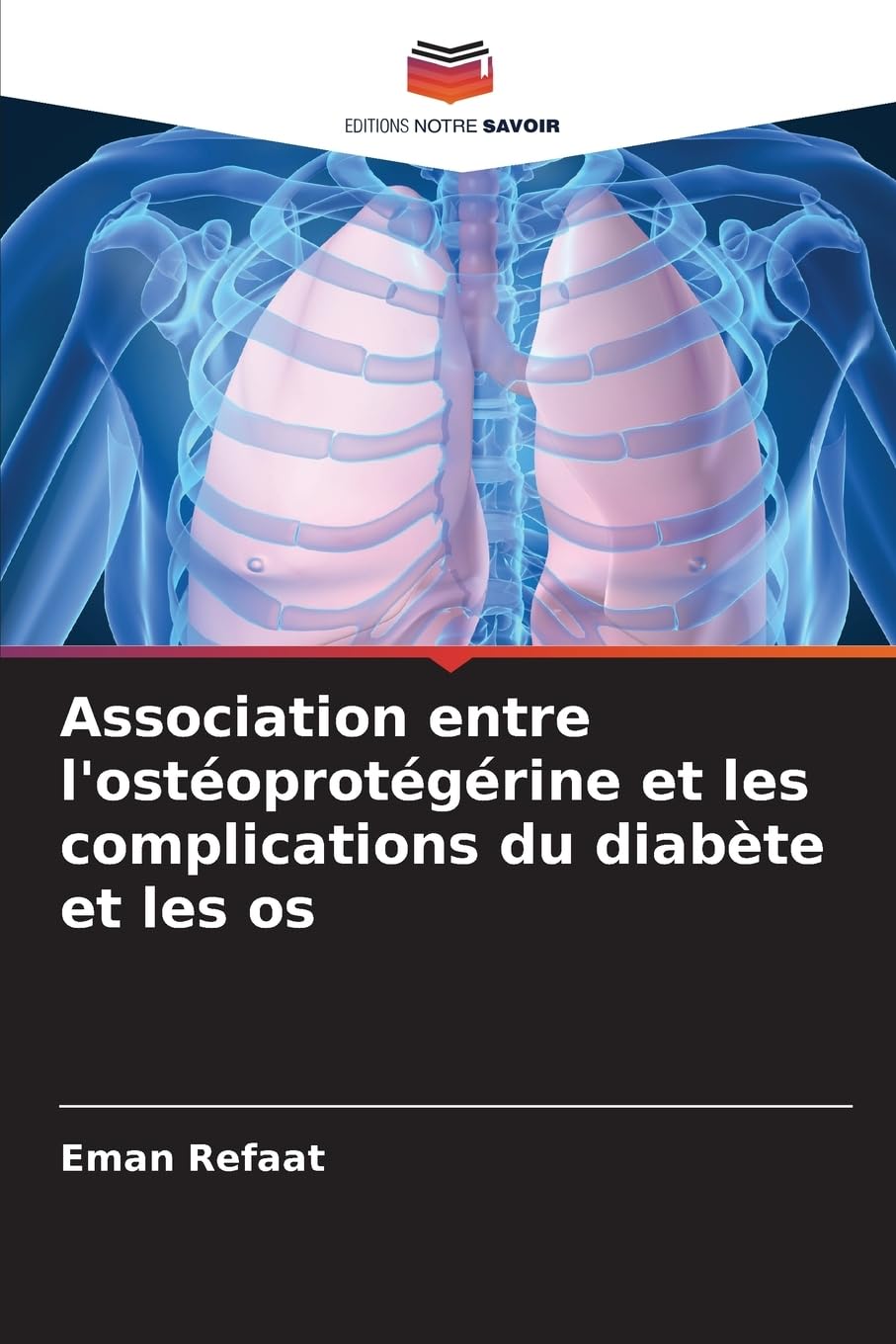 Association entre l'ostéoprotégérine et les complications du diabète et les os Medicine