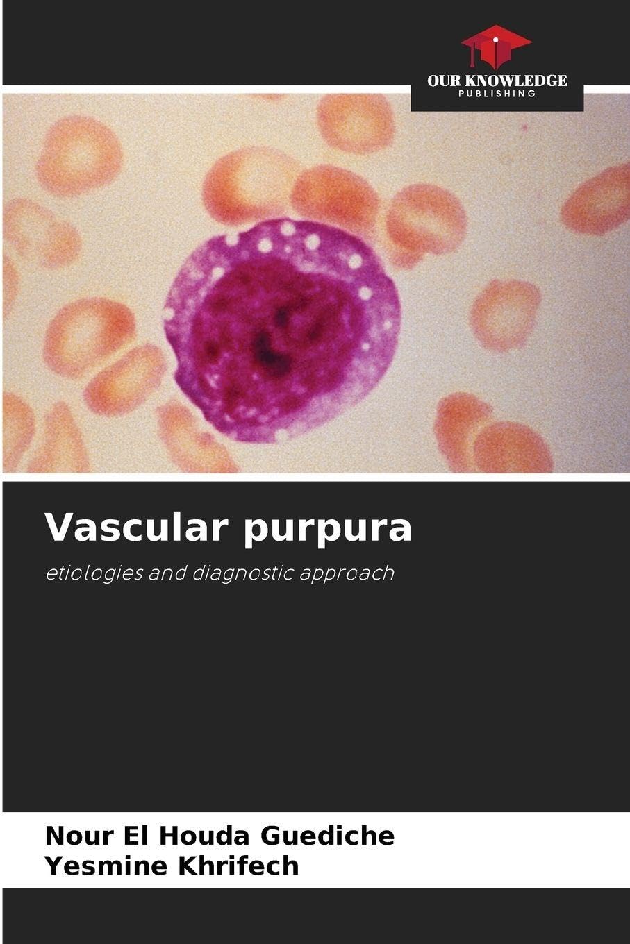 Vascular purpura Medicine