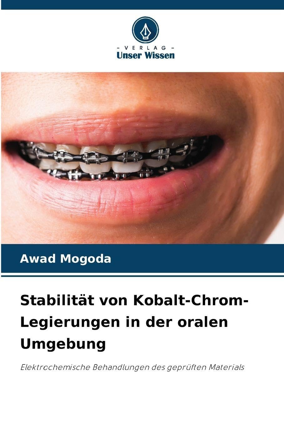 Stabilität von Kobalt-Chrom-Legierungen in der oralen Umgebung Natural Sciences