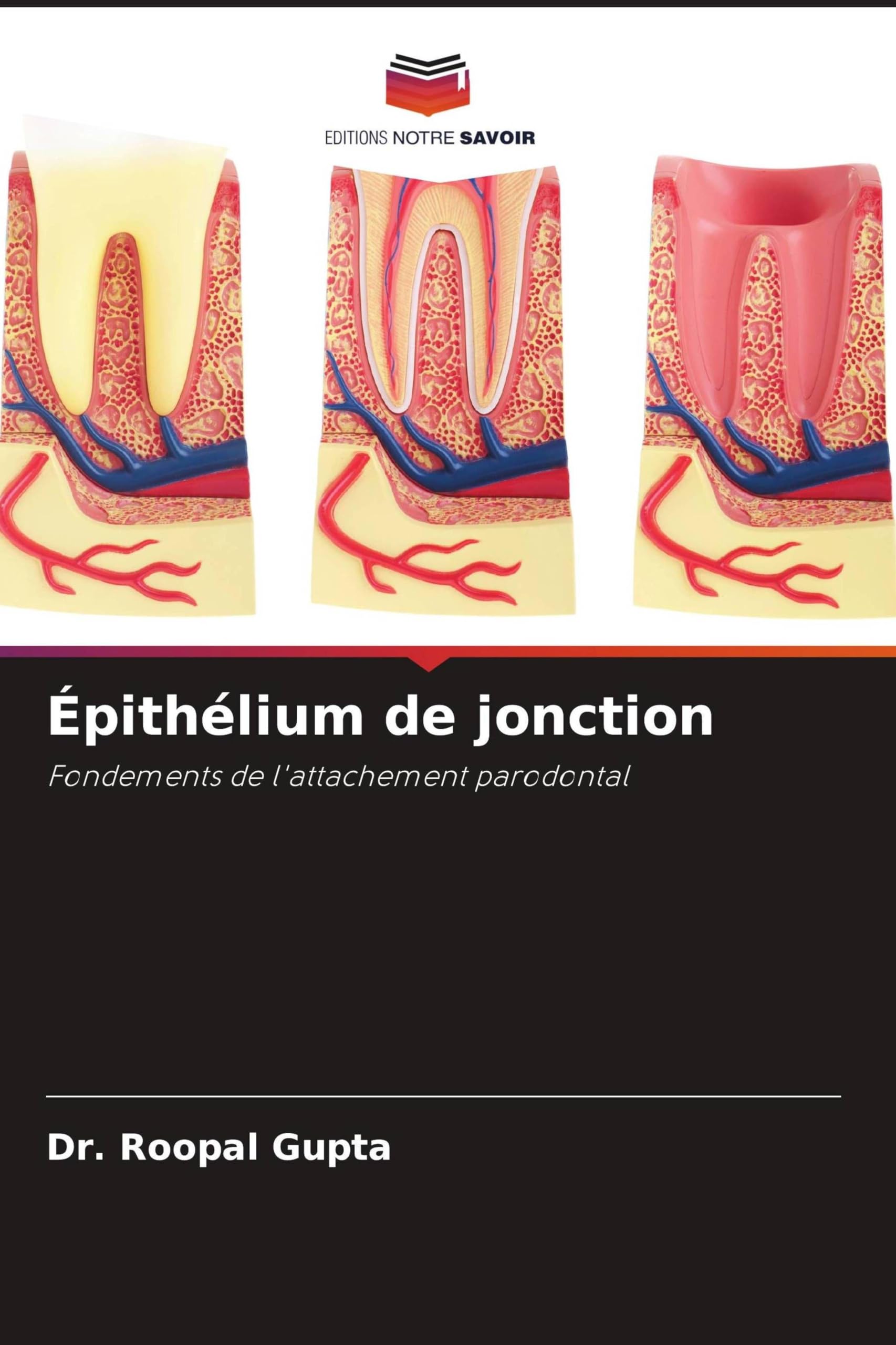 Épithélium de jonction: Fondements de l'attachement parodontal Medicine