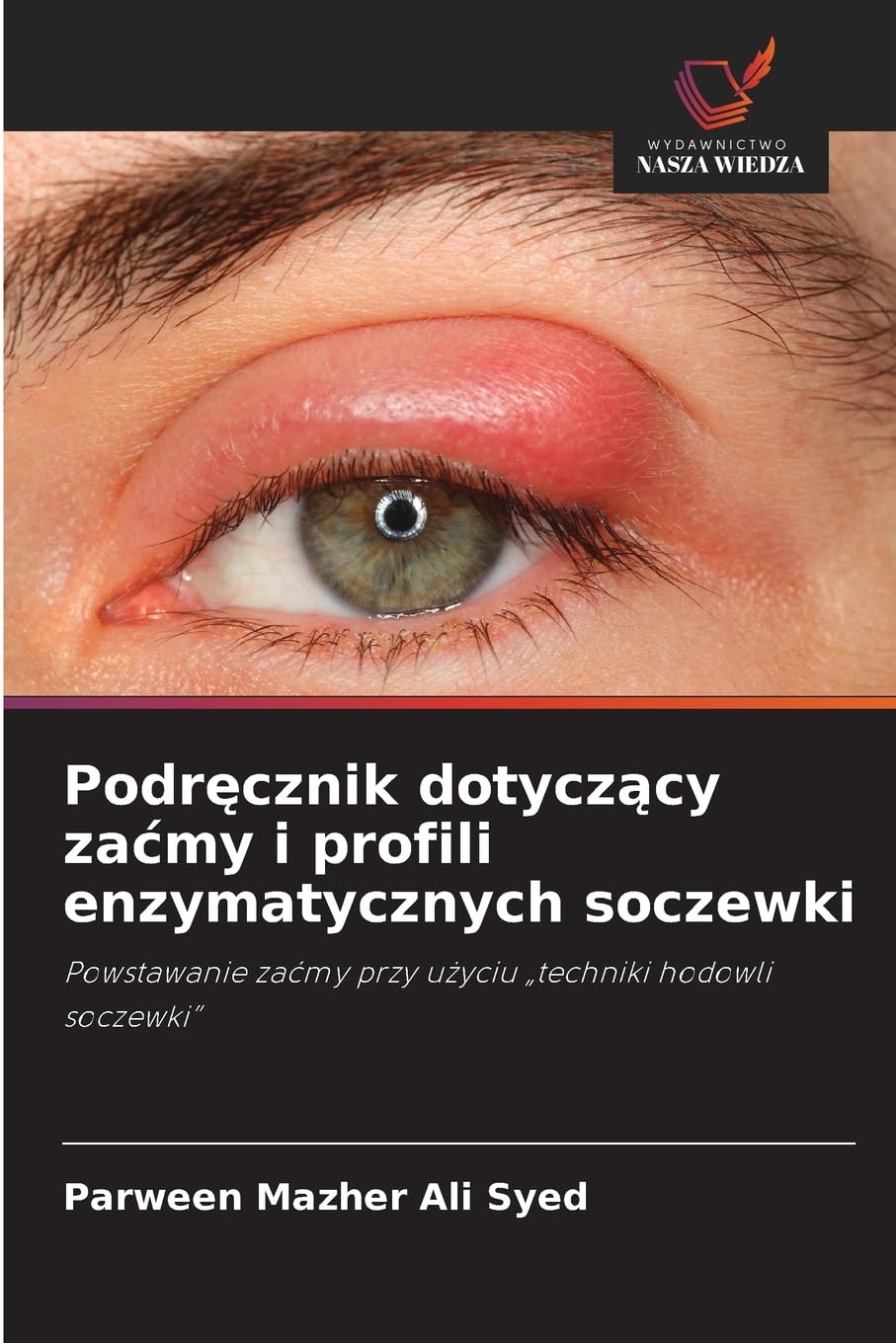 Podr¿cznik dotycz¿cy za¿my i profili enzymatycznych soczewki Natural Sciences
