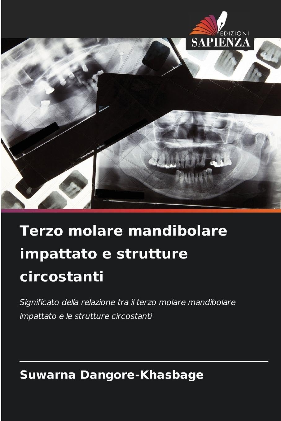 Terzo molare mandibolare impattato e strutture circostanti Medicine