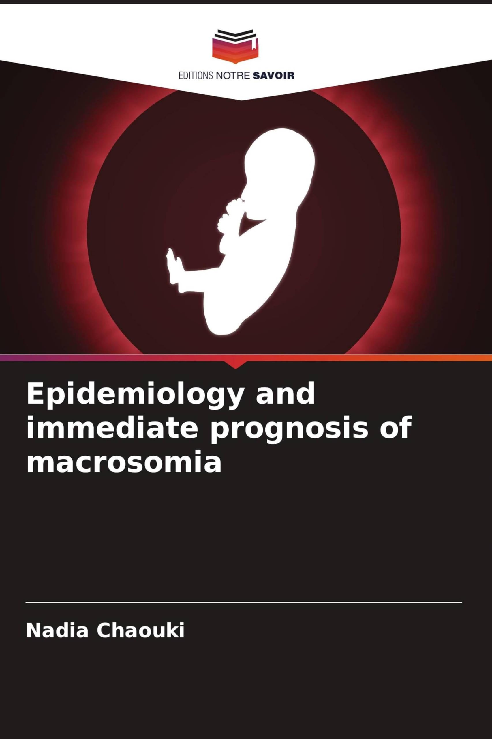 Epidemiology and immediate prognosis of macrosomia Medicine