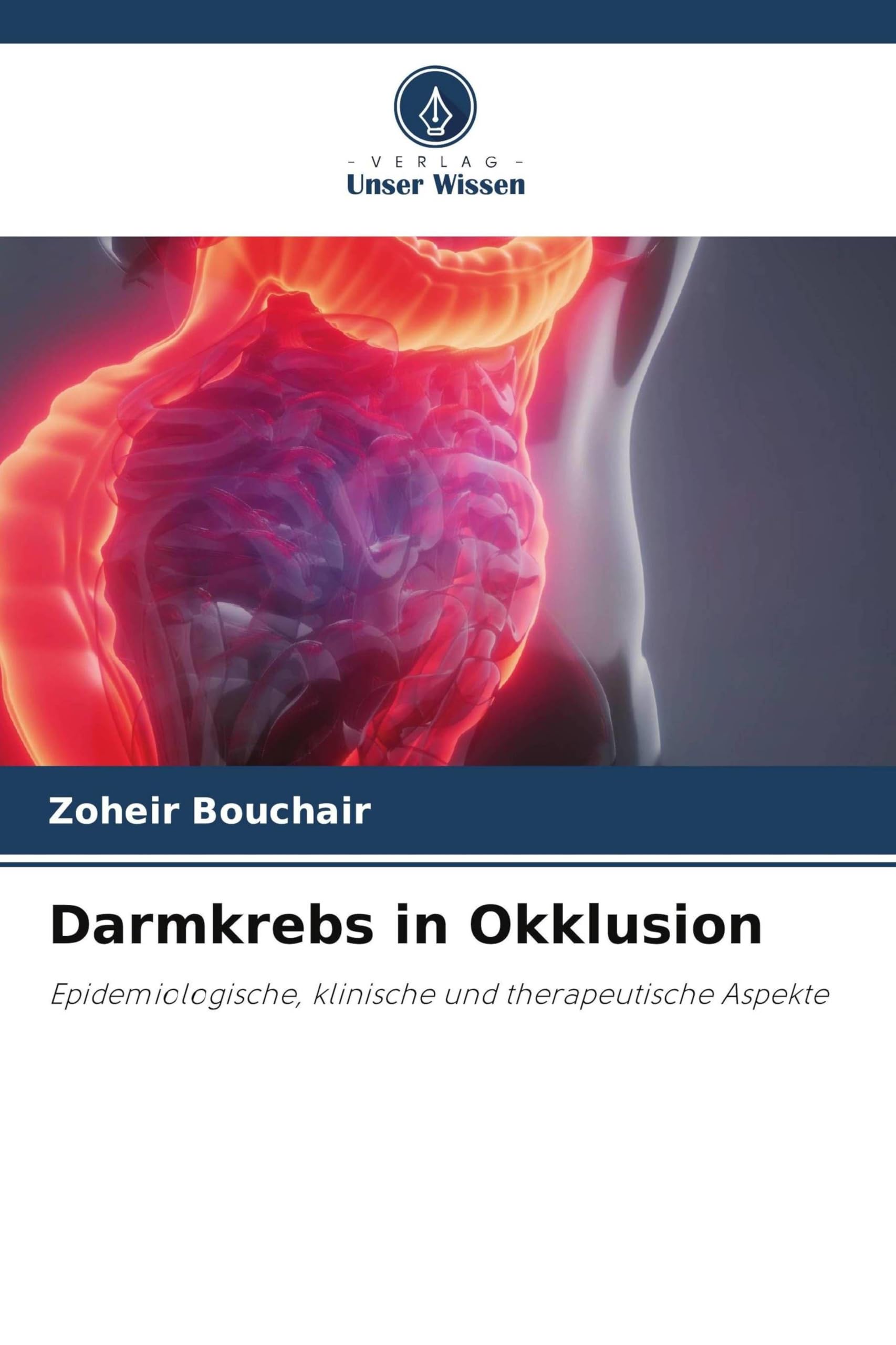 Darmkrebs in Okklusion Medicine