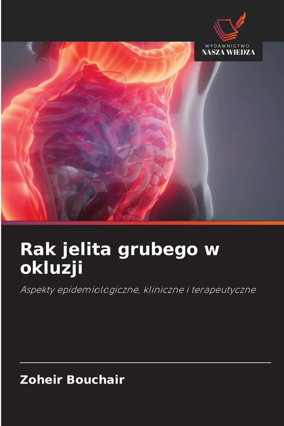 Rak jelita grubego w okluzji Medicine