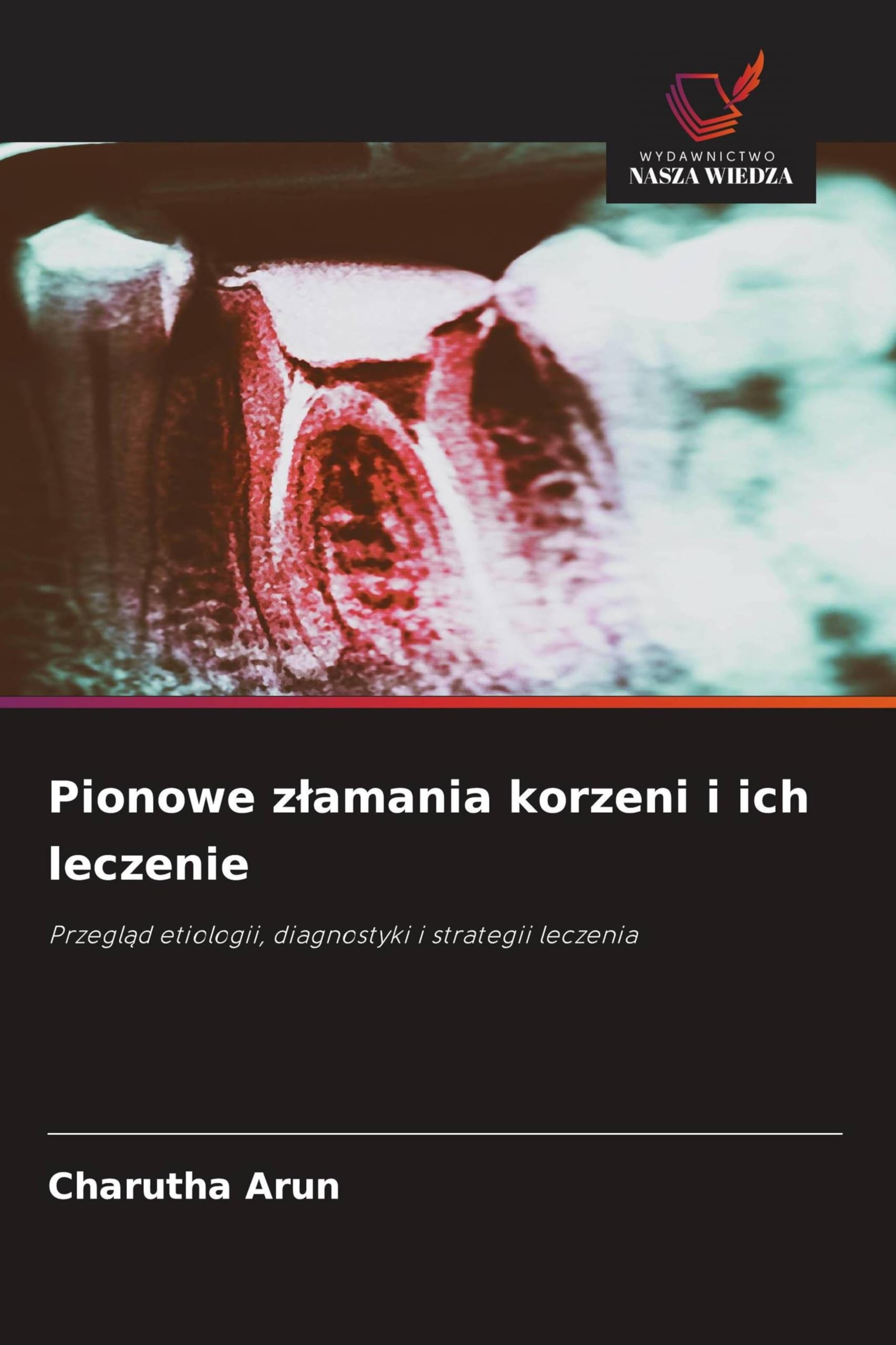 Pionowe z¿amania korzeni i ich leczenie Medicine