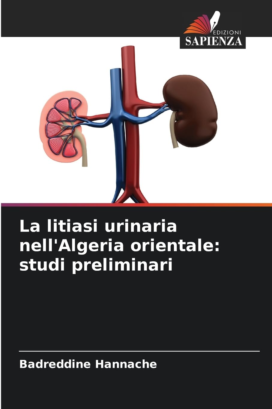 La litiasi urinaria nell'Algeria orientale: studi preliminari Natural Sciences