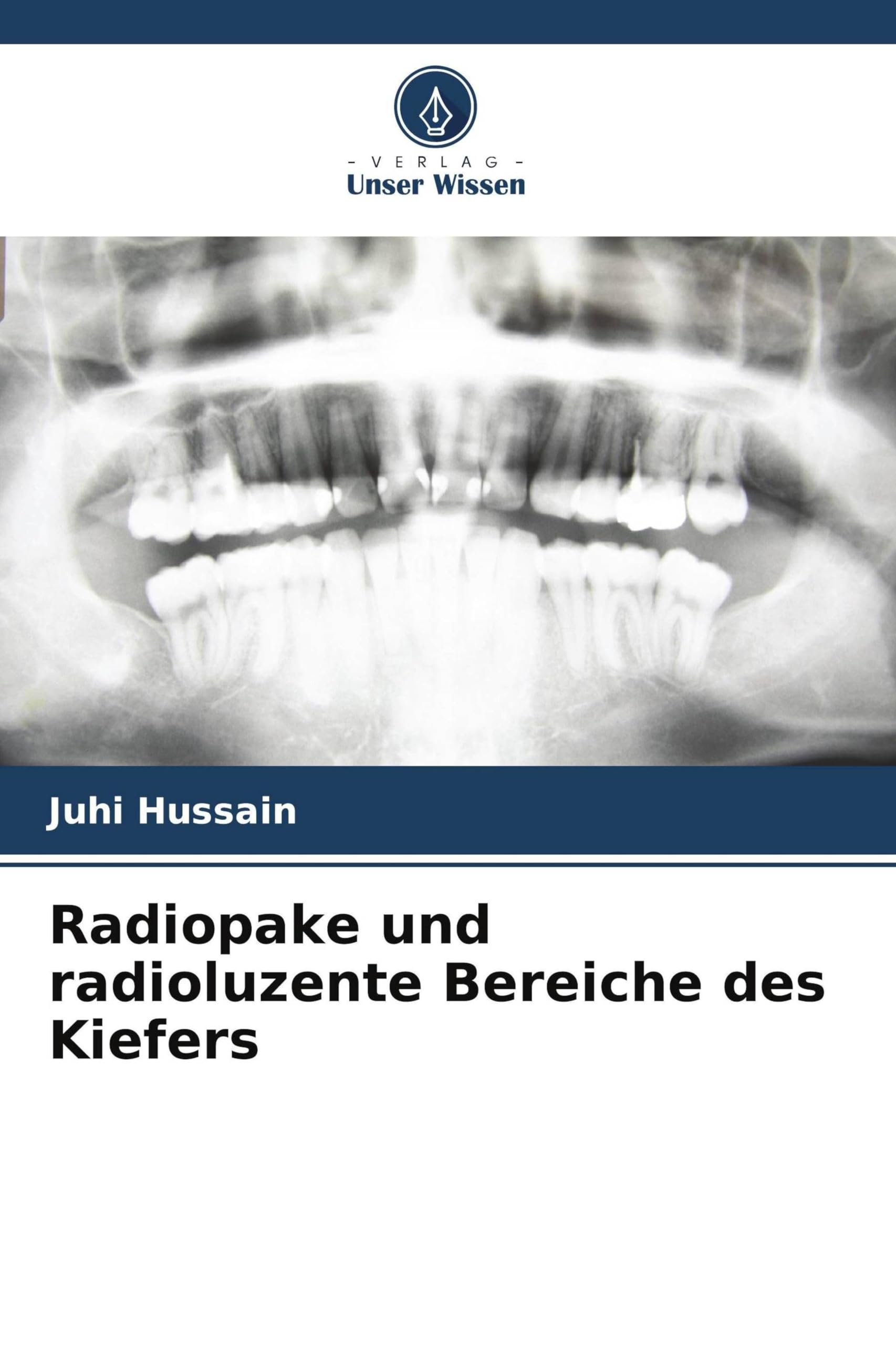 Radiopake und radioluzente Bereiche des Kiefers Medicine