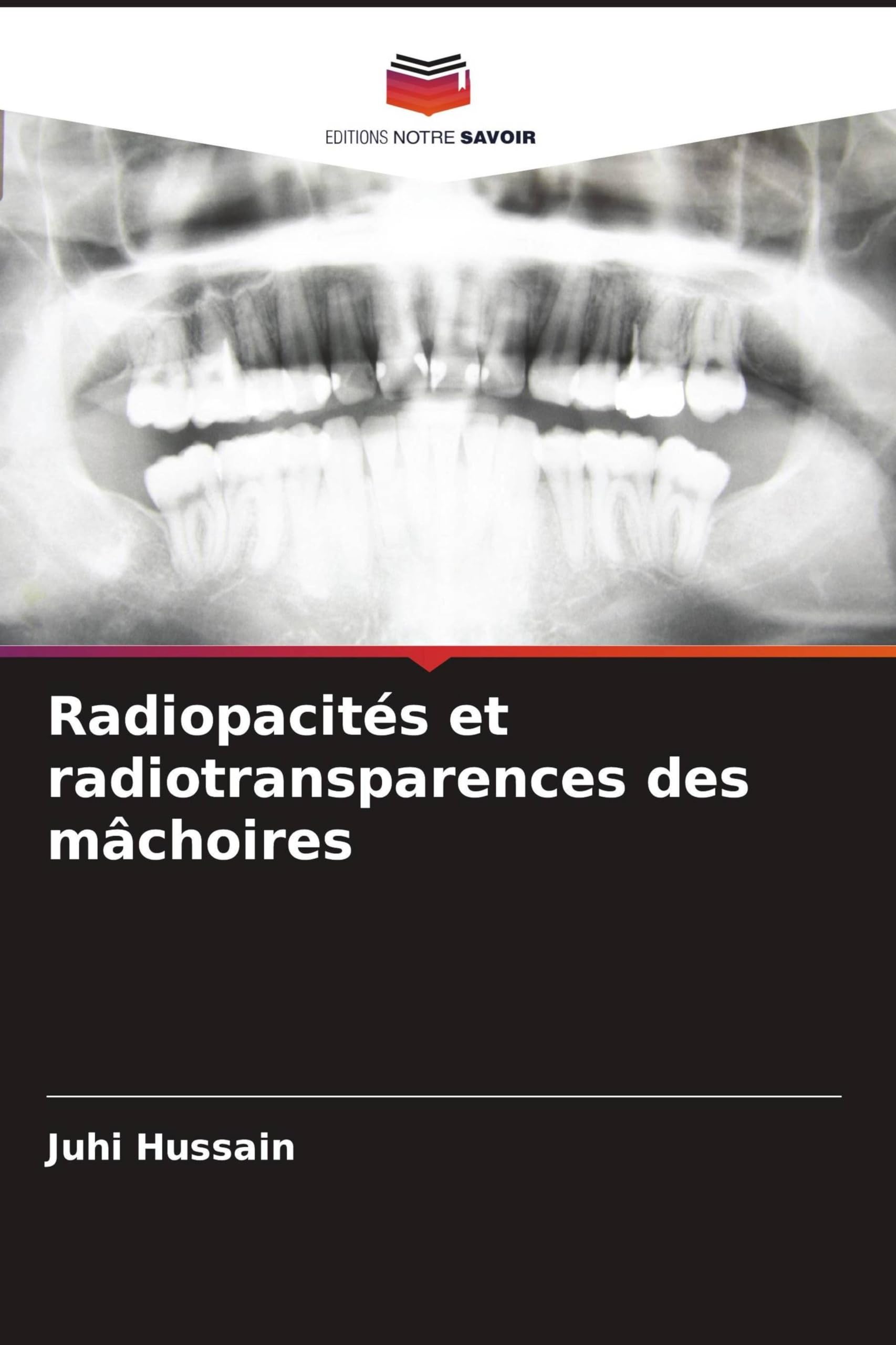 Radiopacités et radiotransparences des mâchoires Medicine