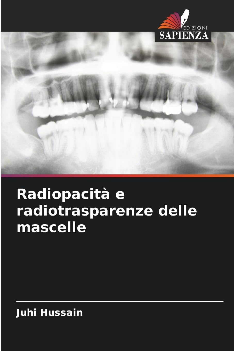 Radiopacità e radiotrasparenze delle mascelle Medicine