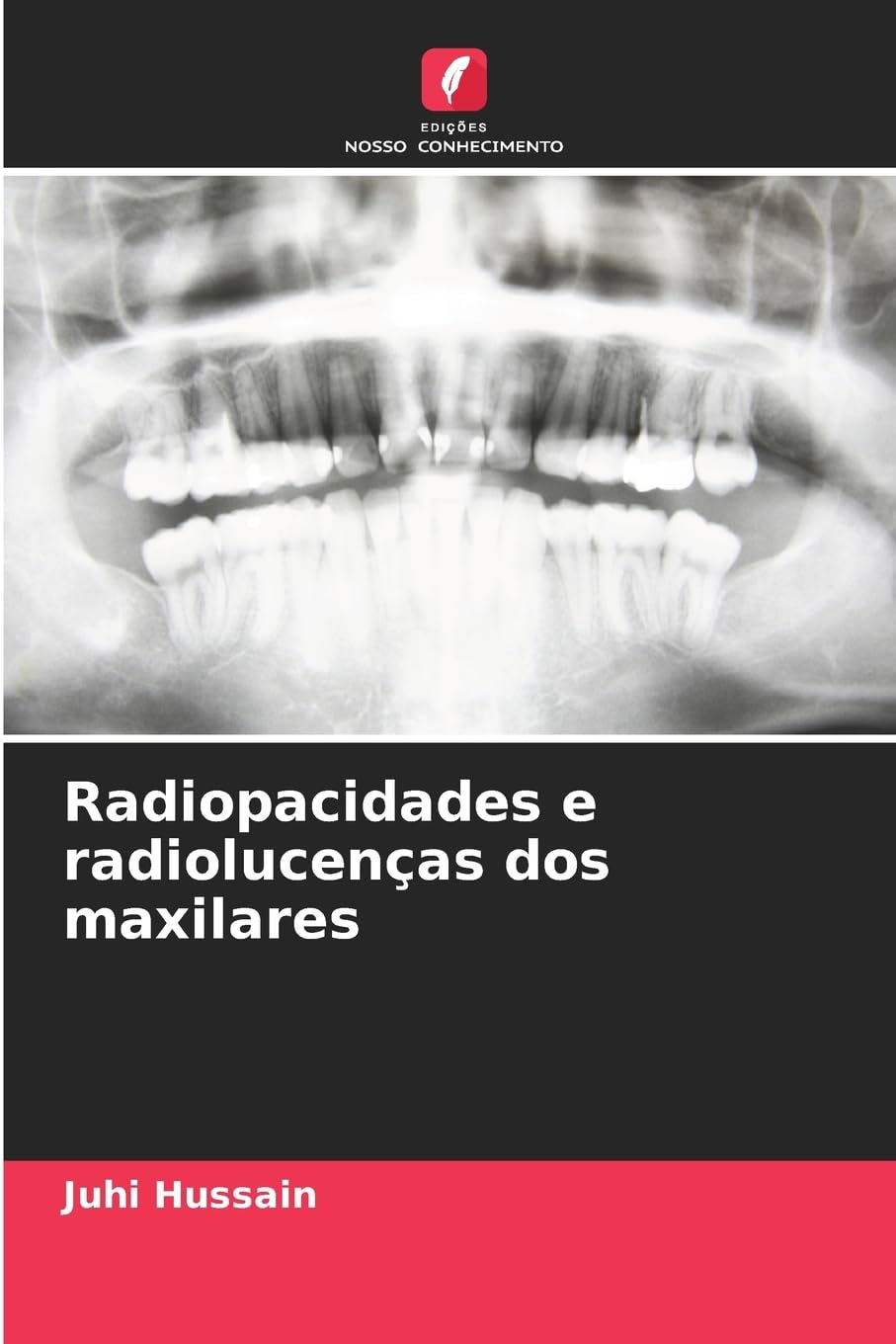 Radiopacidades e radiolucenças dos maxilares Medicine