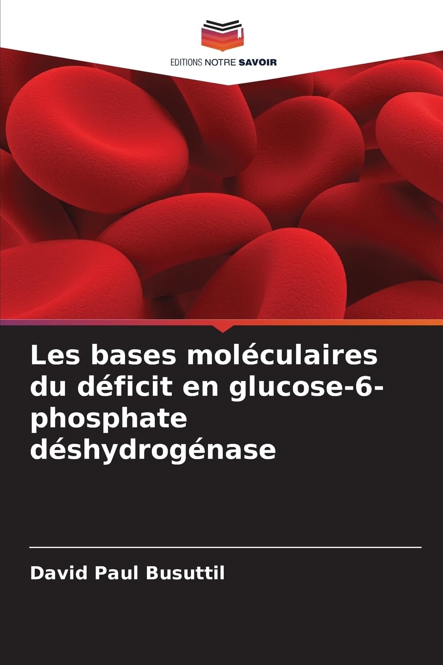 Les bases moléculaires du déficit en glucose-6-phosphate déshydrogénase: DE Medicine