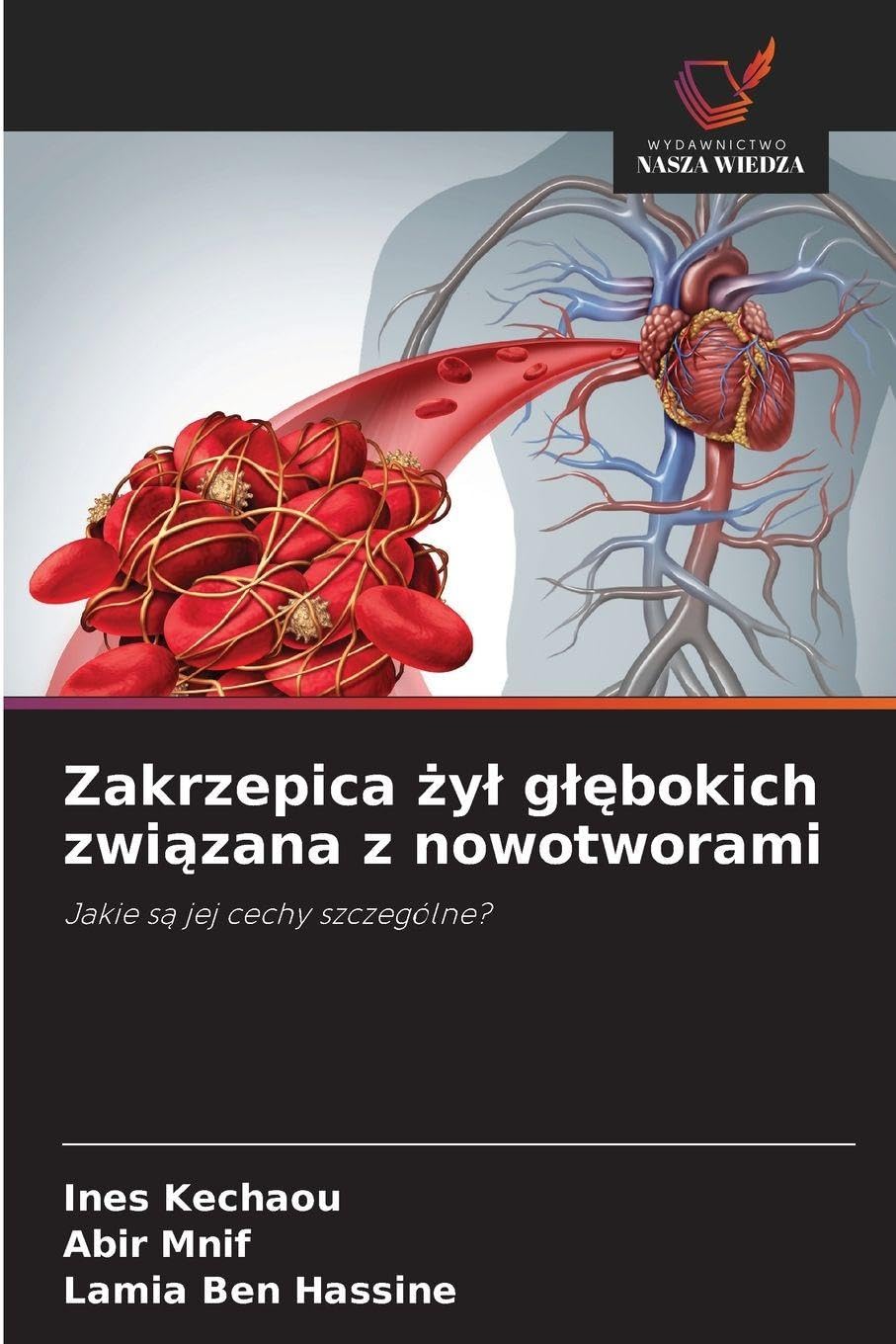Zakrzepica ¿y¿ g¿¿bokich zwi¿zana z nowotworami Medicine