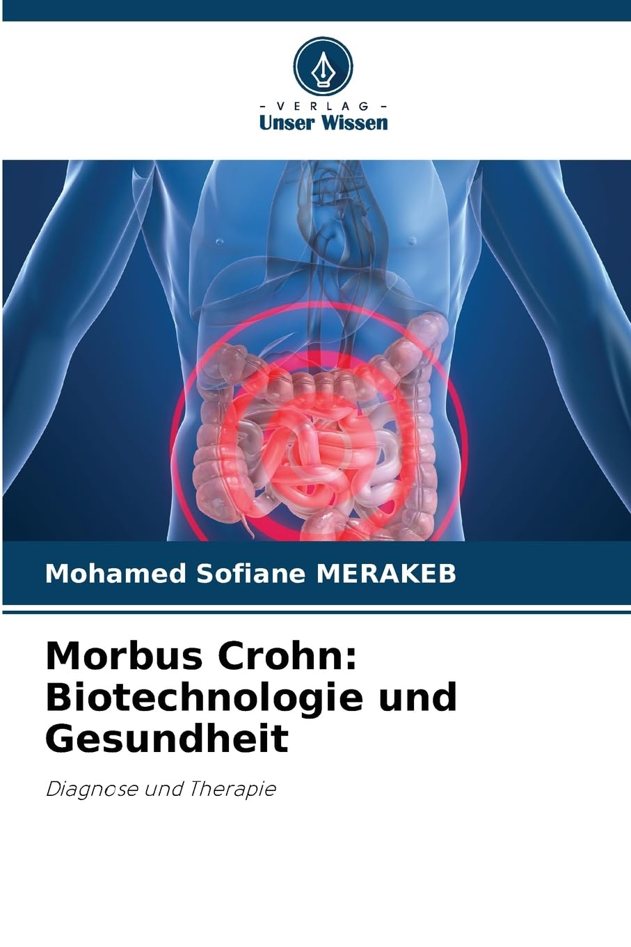 Morbus Crohn: Biotechnologie und Gesundheit Natural Sciences