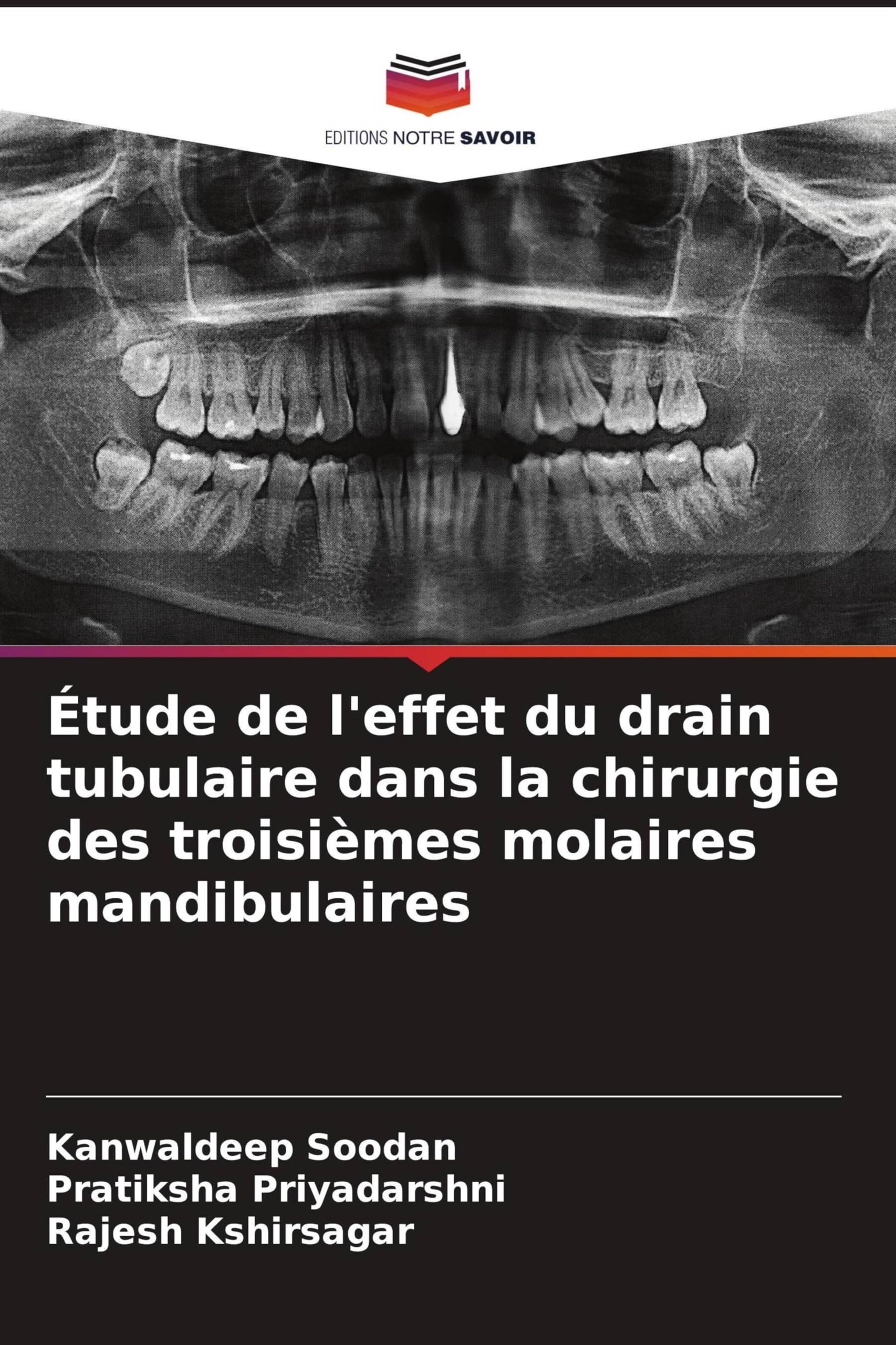 Étude de l'effet du drain tubulaire dans la chirurgie des troisièmes molaires mandibulaires Medicine