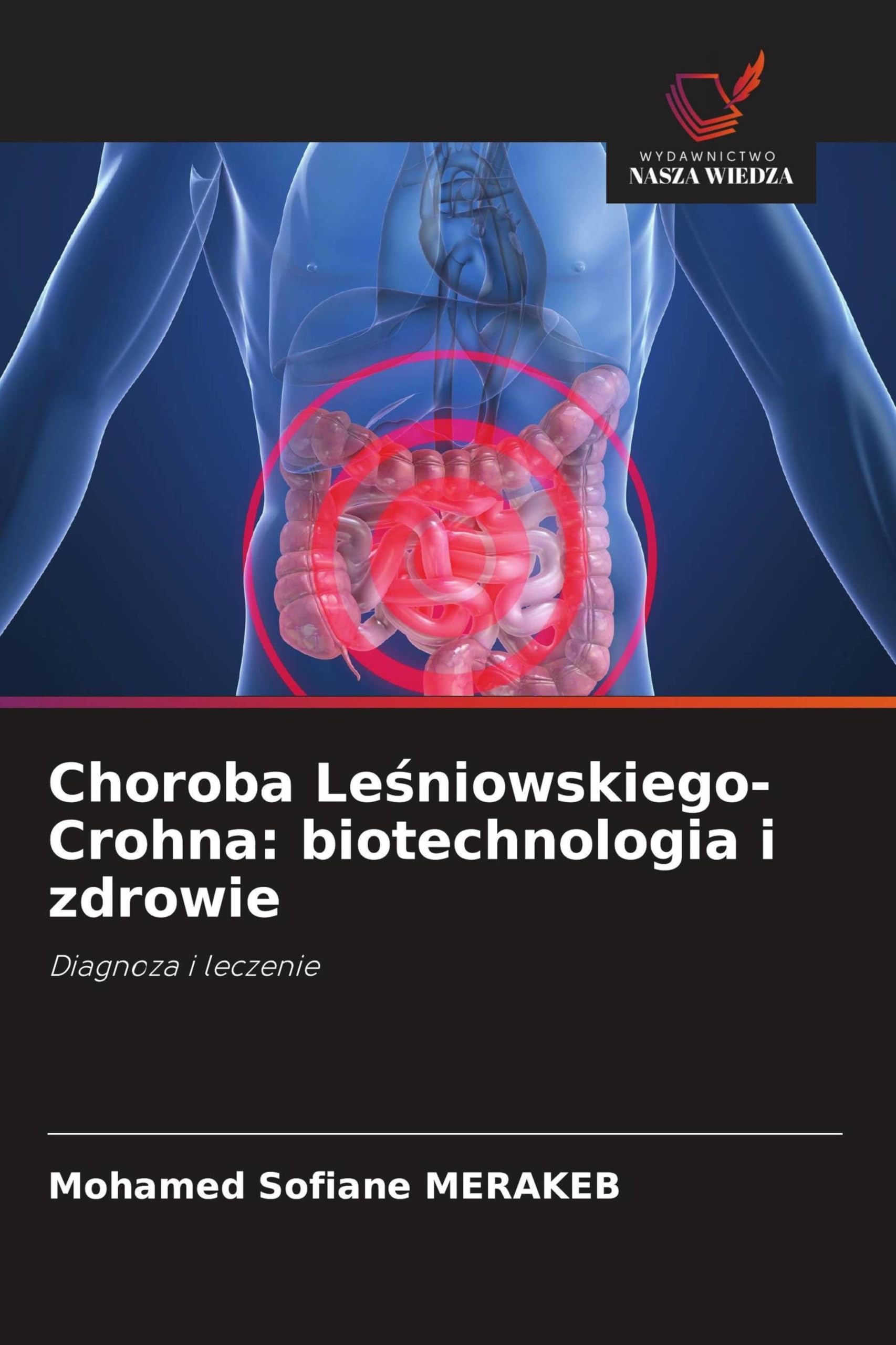 Choroba Le¿niowskiego-Crohna: biotechnologia i zdrowie Natural Sciences
