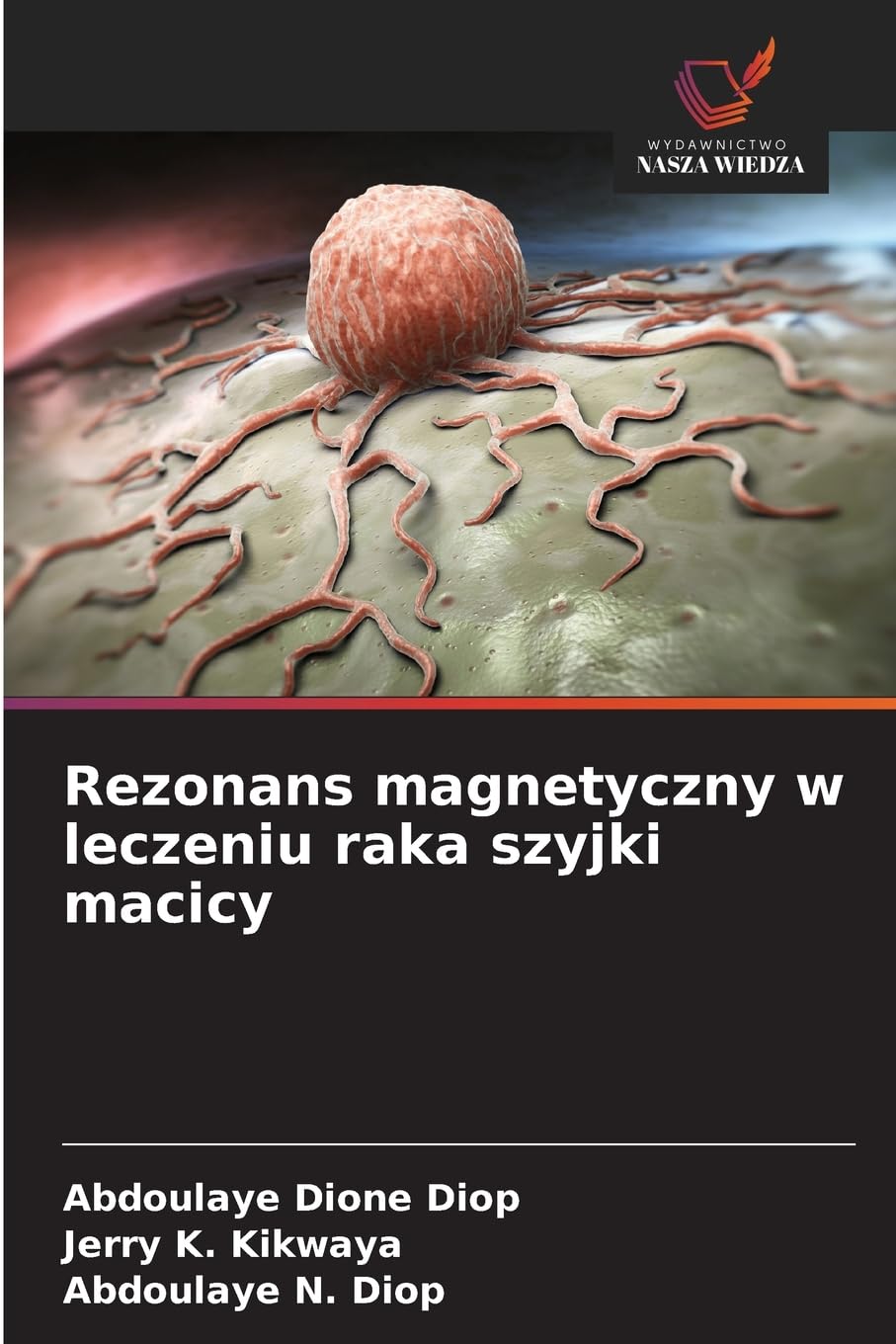 Rezonans magnetyczny w leczeniu raka szyjki macicy Medicine