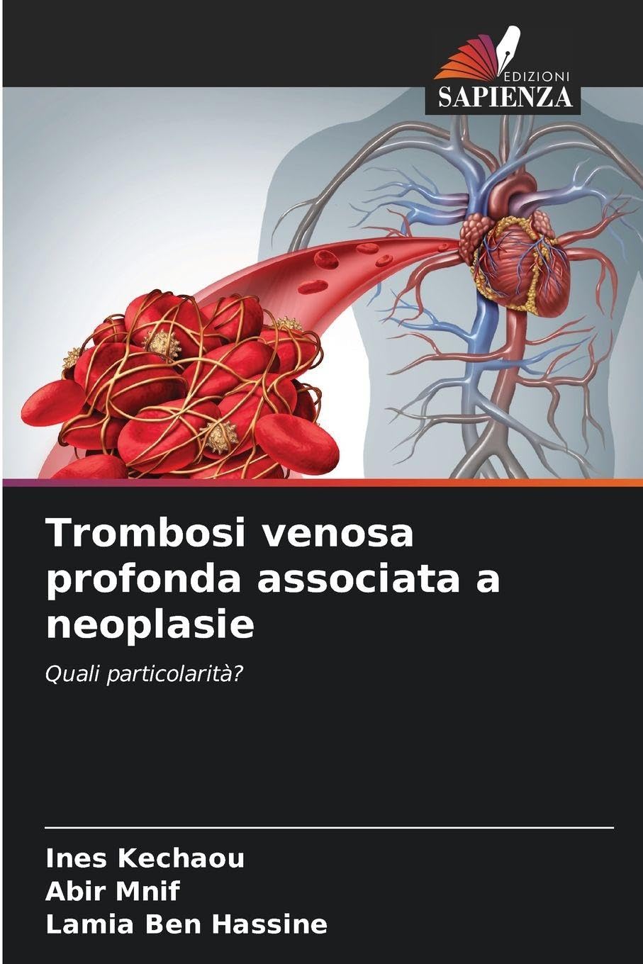 Trombosi venosa profonda associata a neoplasie Medicine