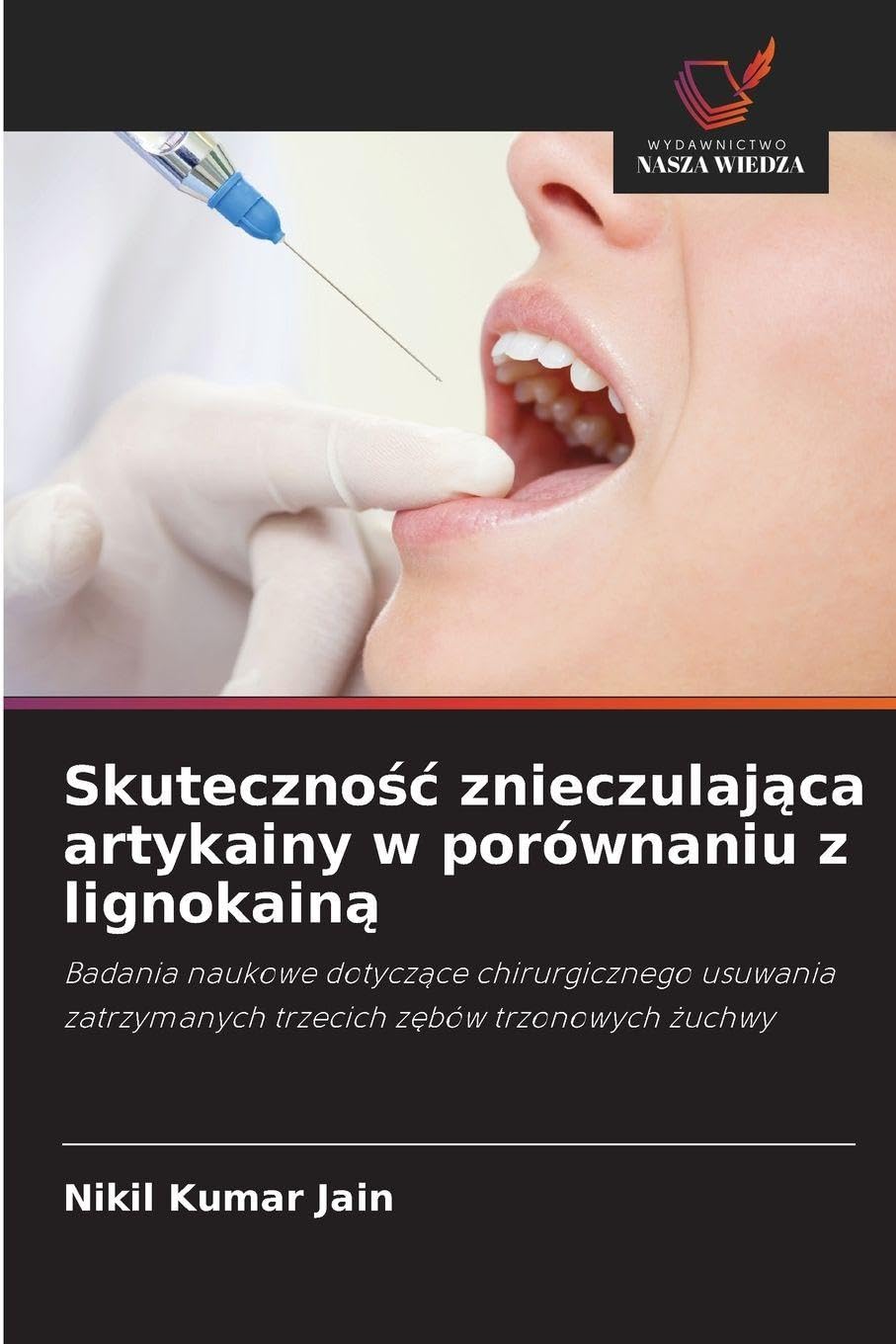 Skuteczno¿¿ znieczulaj¿ca artykainy w porównaniu z lignokain¿ Medicine