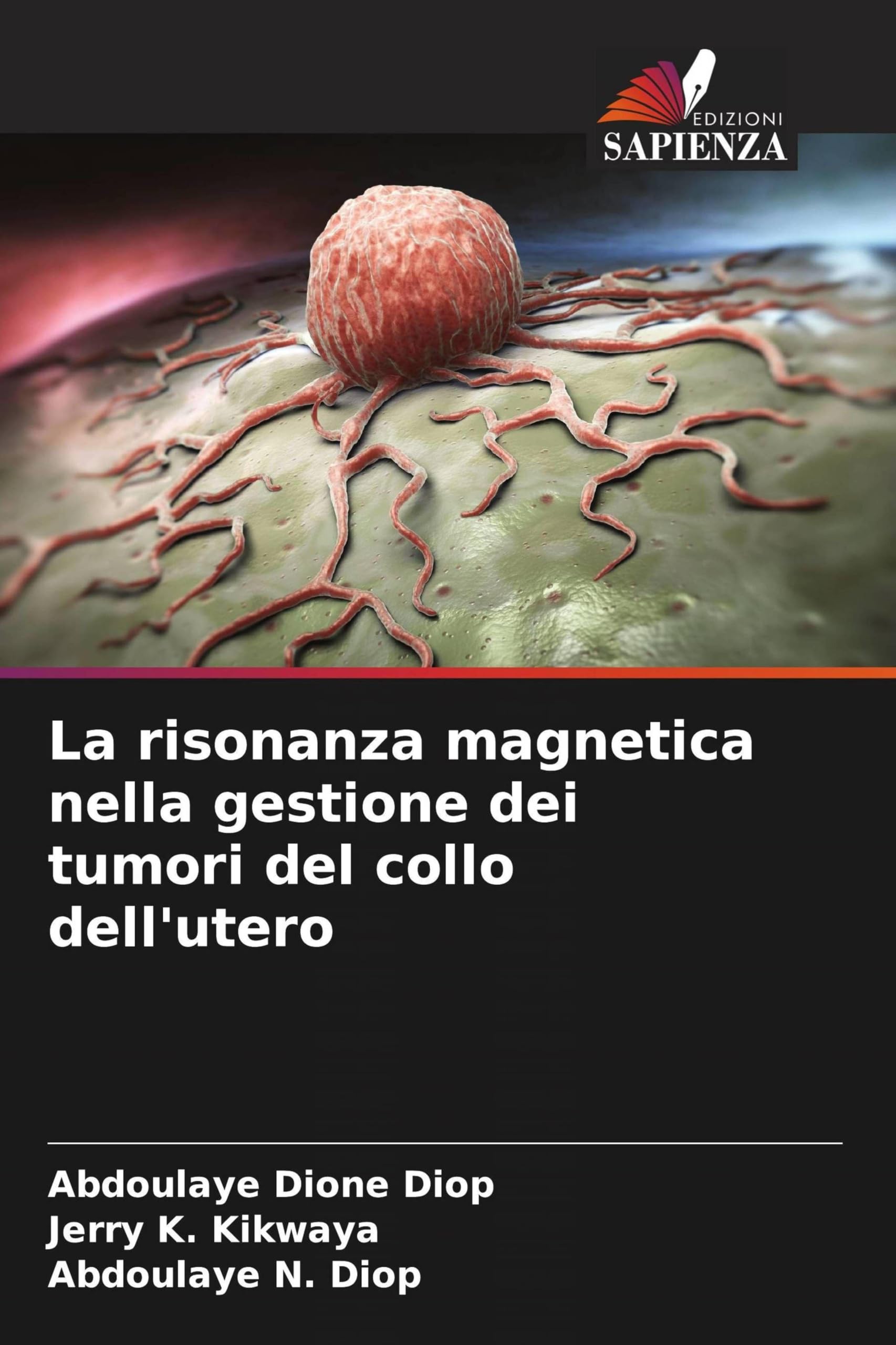 La risonanza magnetica nella gestione dei tumori del collo dell'utero Medicine