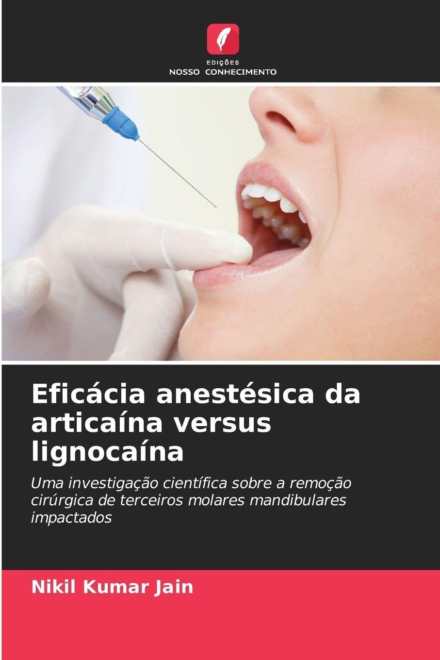Eficácia anestésica da articaína versus lignocaína Medicine