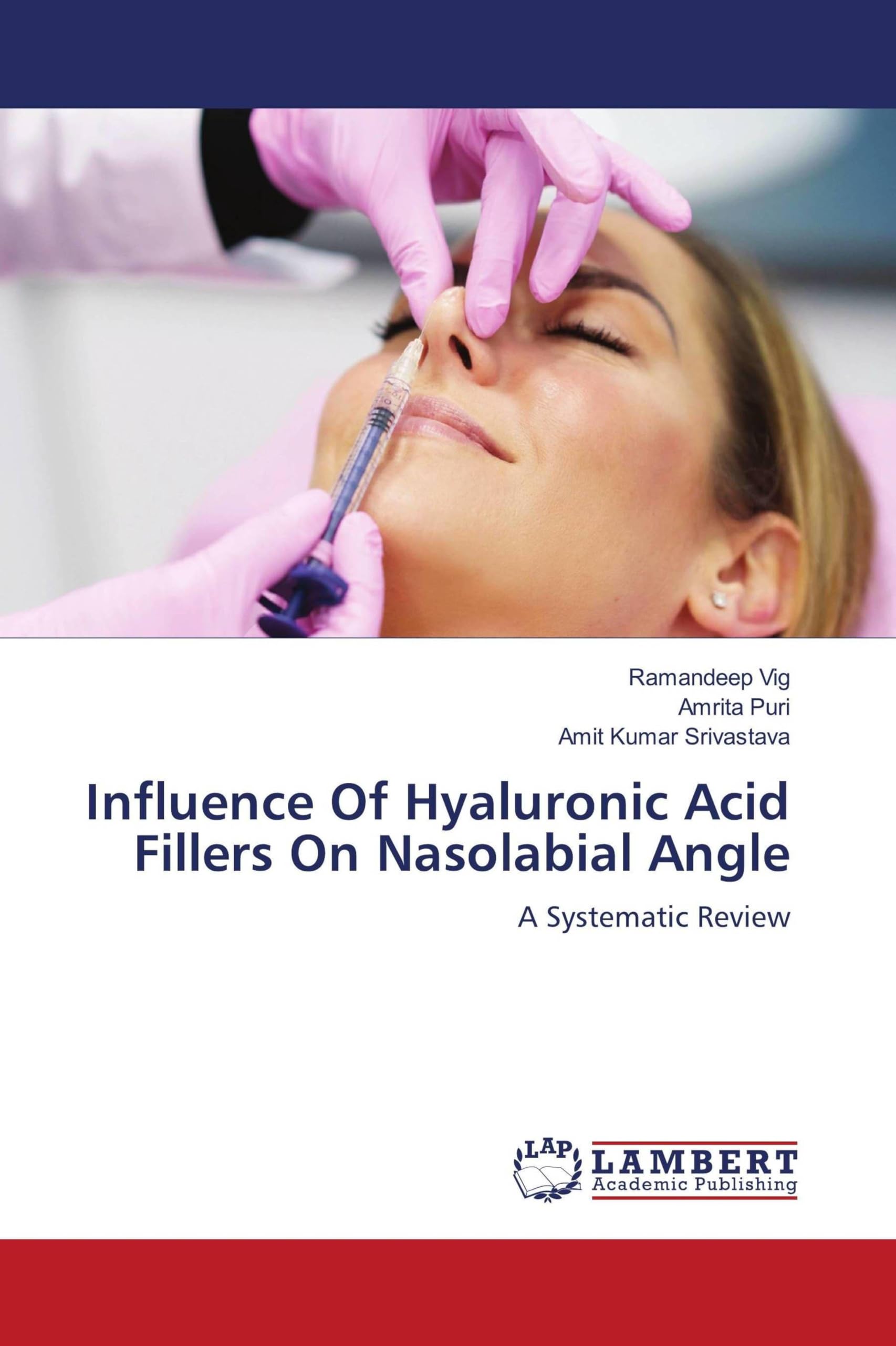 Influence Of Hyaluronic Acid Fillers On Nasolabial Angle Medicine