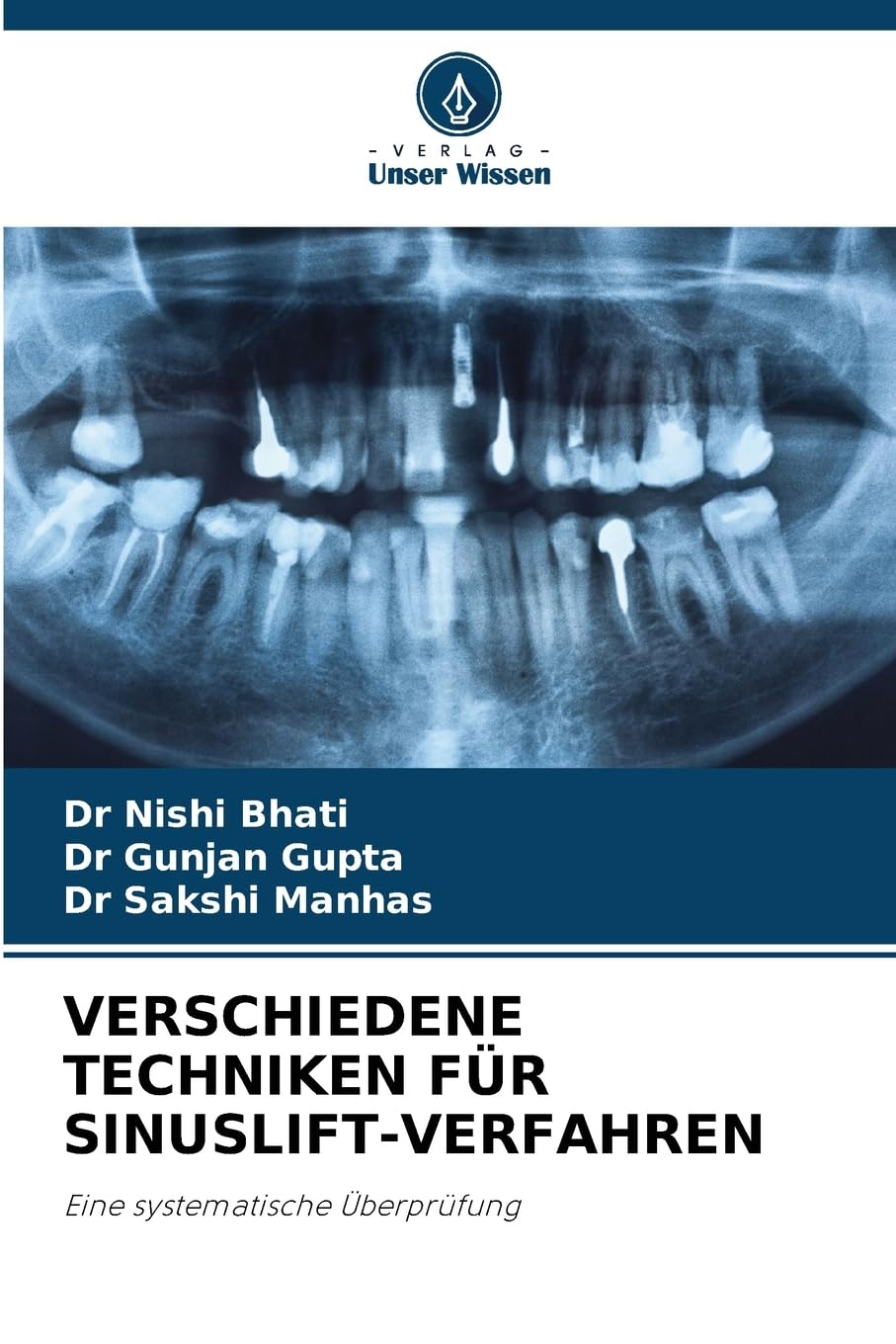 VERSCHIEDENE TECHNIKEN FÜR SINUSLIFT-VERFAHREN Medicine