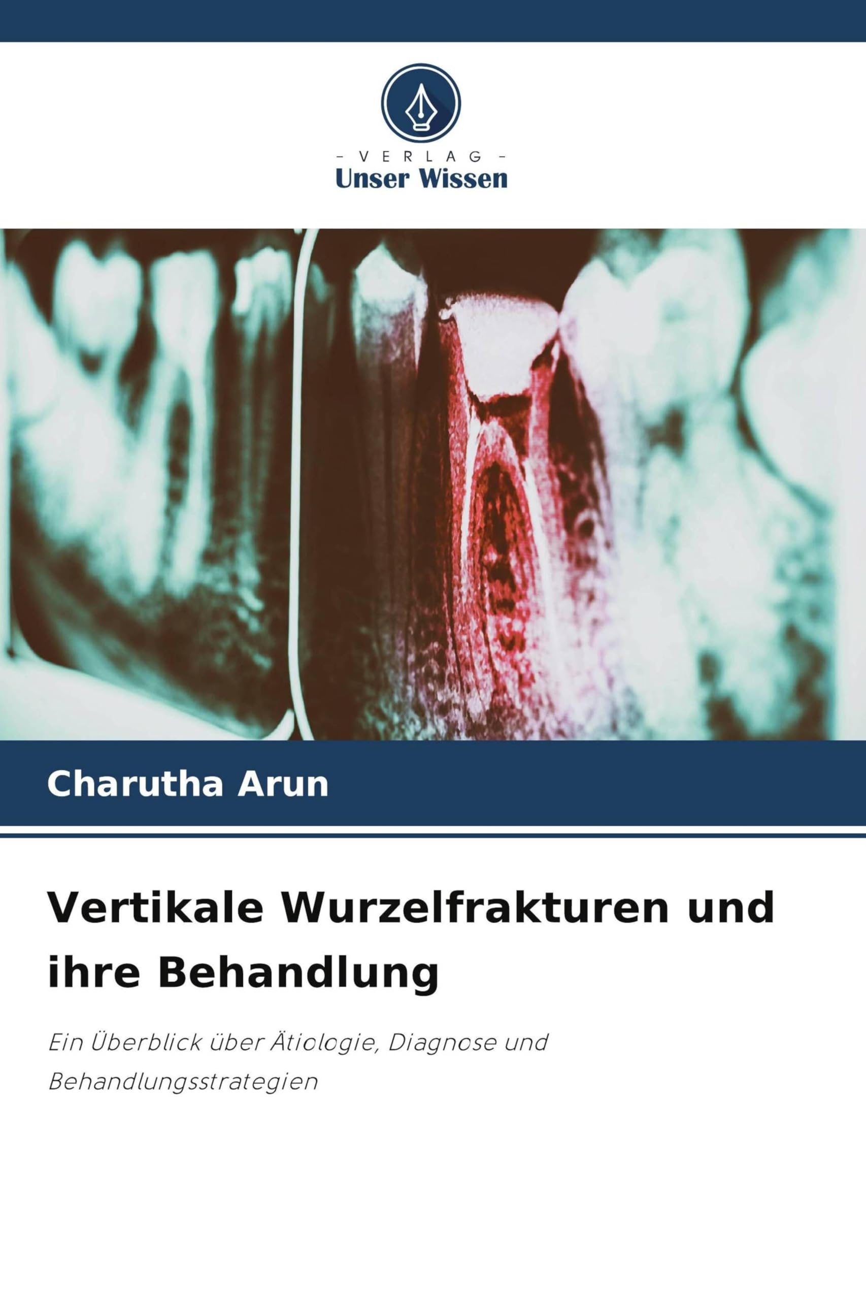 Vertikale Wurzelfrakturen und ihre Behandlung Medicine