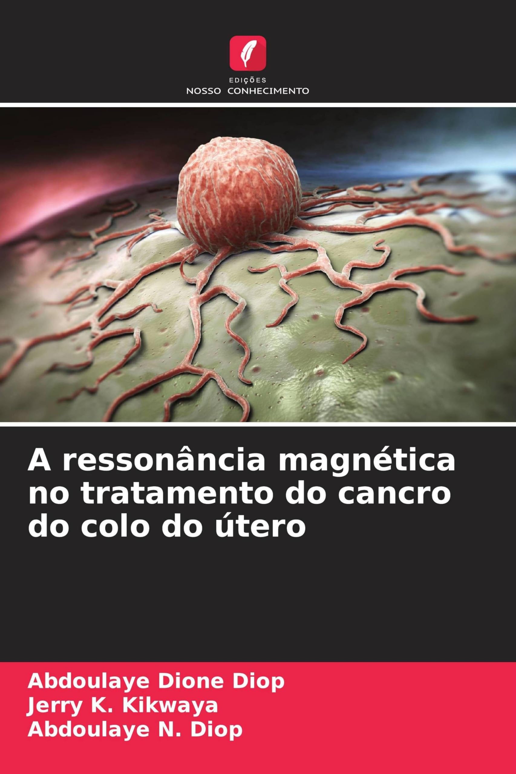 A ressonância magnética no tratamento do cancro do colo do útero Medicine