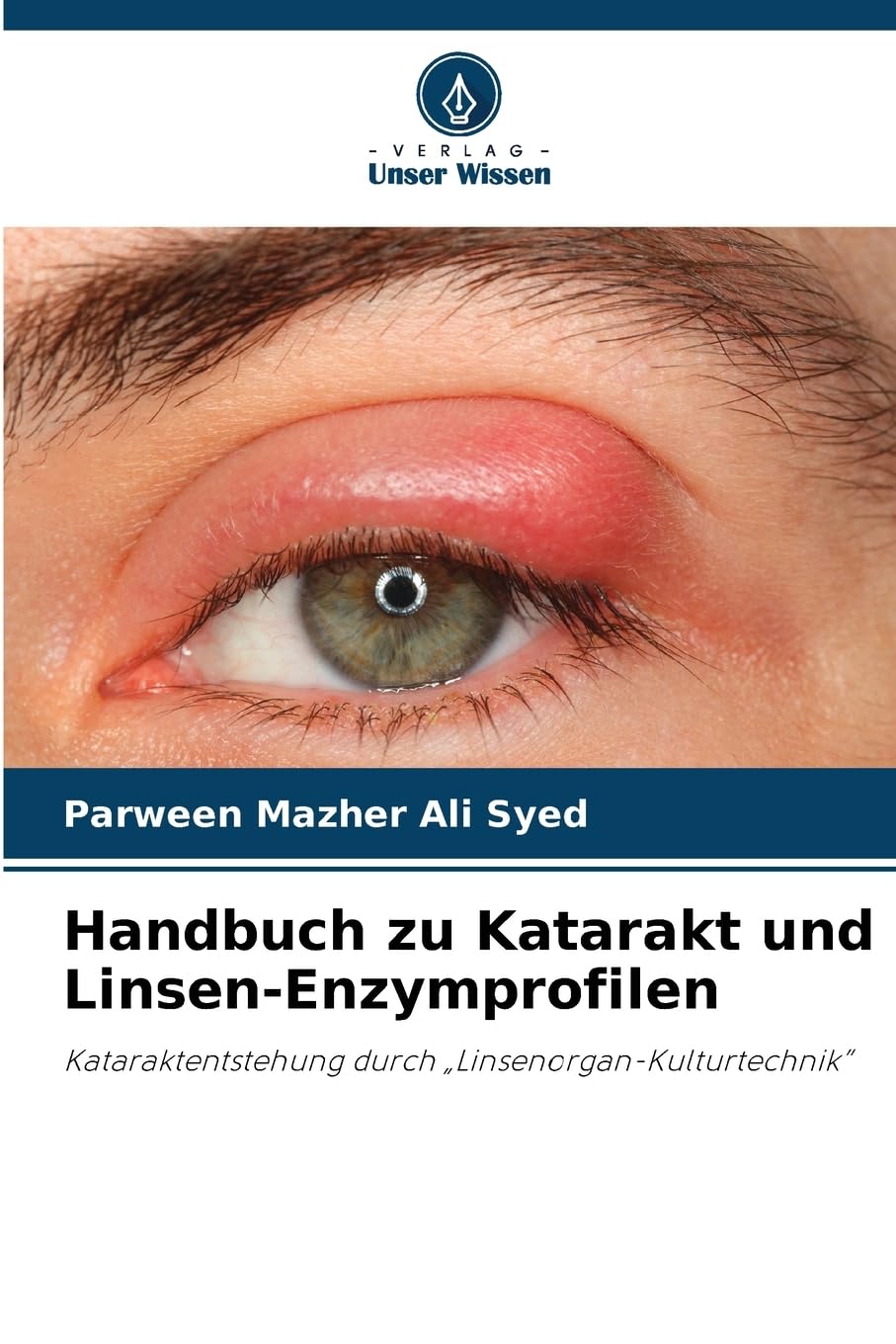 Handbuch zu Katarakt und Linsen-Enzymprofilen Natural Sciences