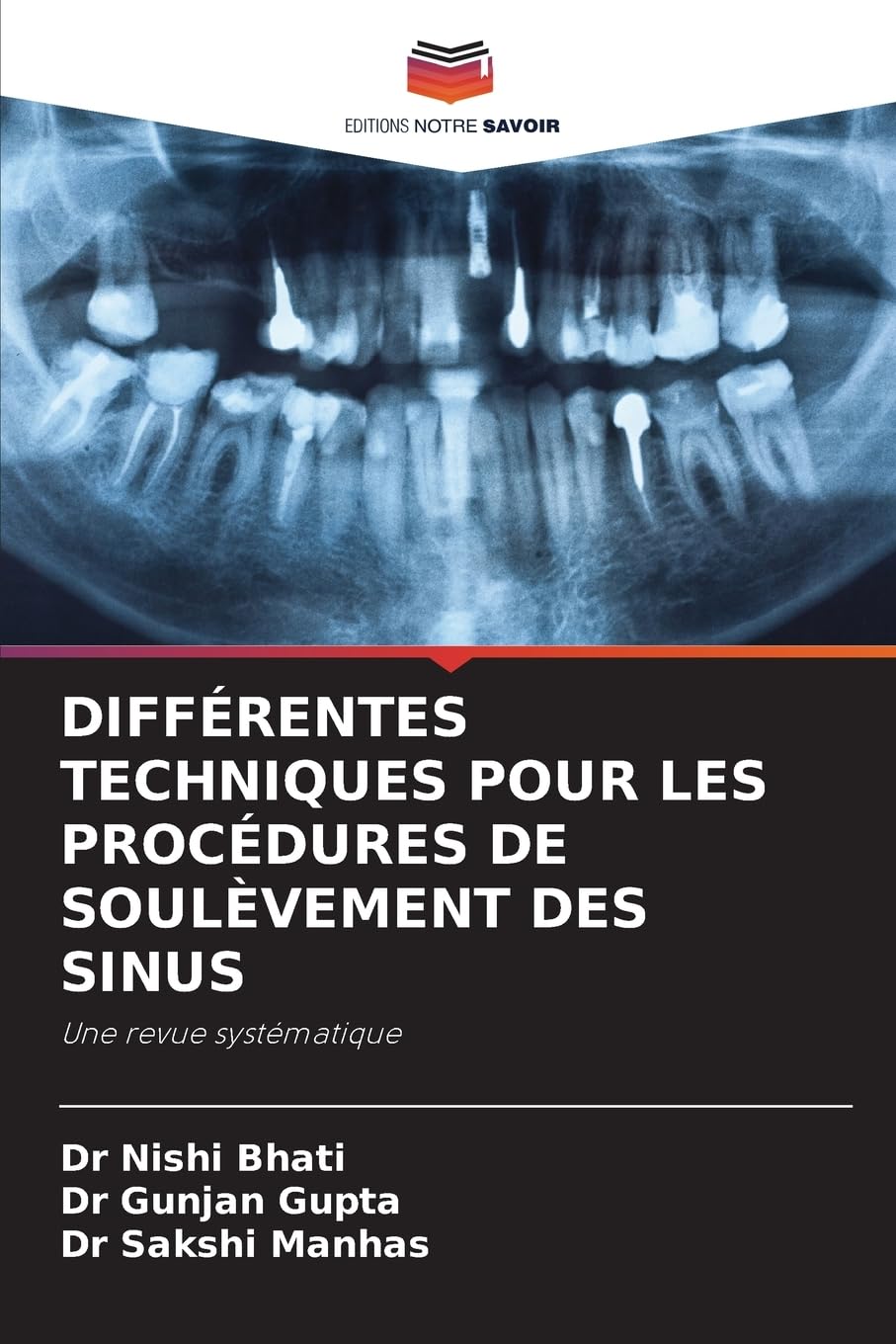 DIFFÉRENTES TECHNIQUES POUR LES PROCÉDURES DE SOULÈVEMENT DES SINUS: Une revue systématique Medicine