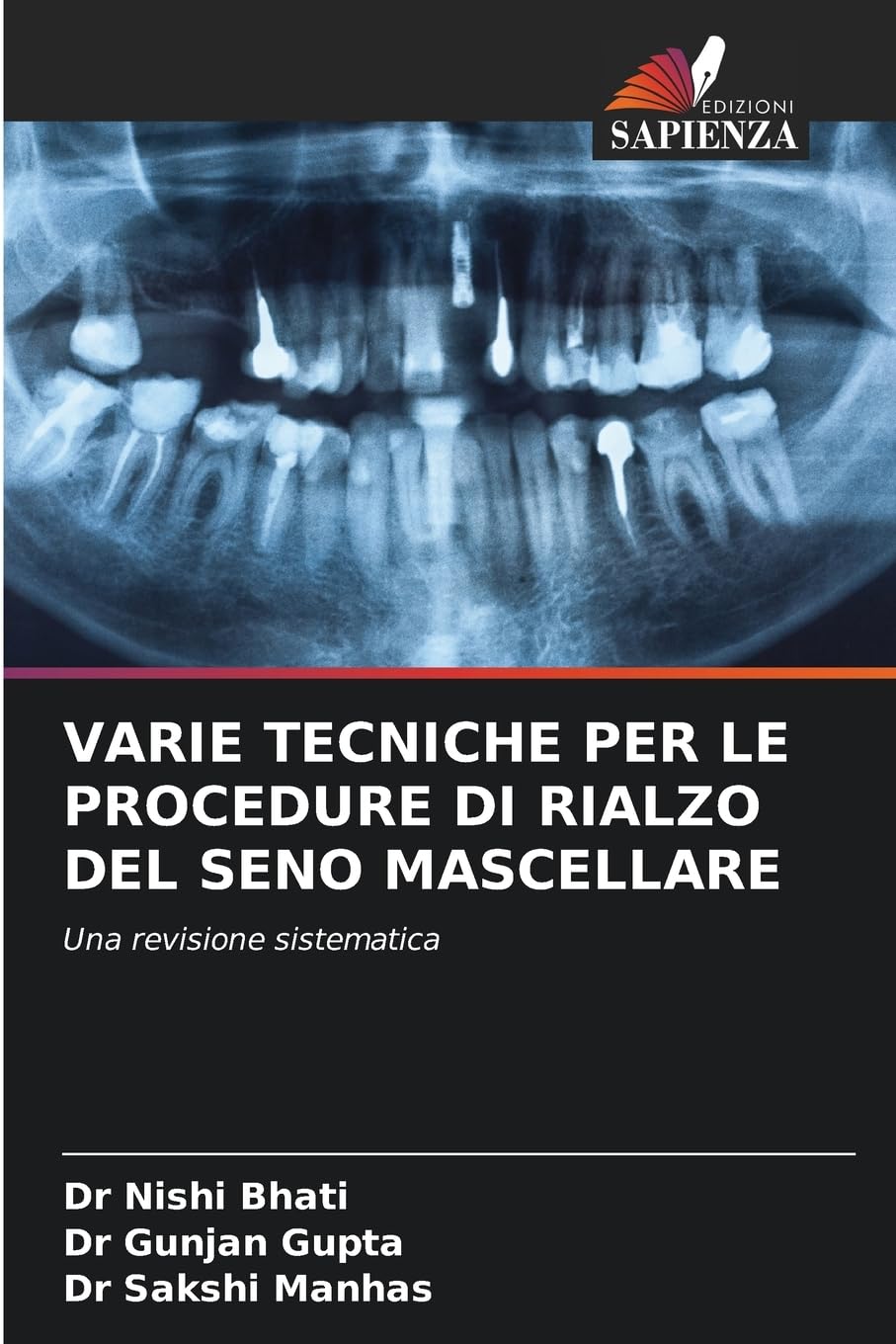 VARIE TECNICHE PER LE PROCEDURE DI RIALZO DEL SENO MASCELLARE Medicine