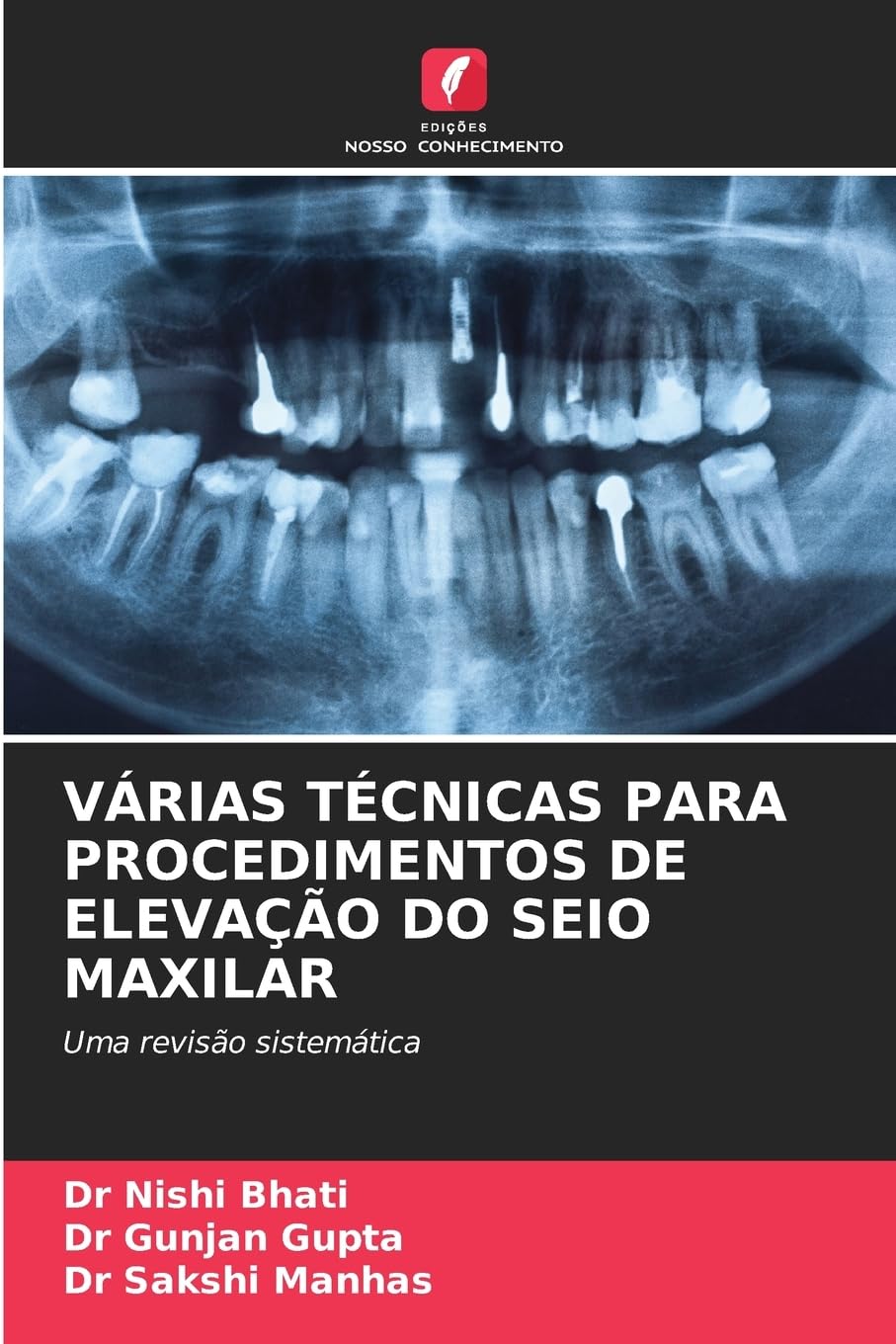 VÁRIAS TÉCNICAS PARA PROCEDIMENTOS DE ELEVAÇÃO DO SEIO MAXILAR Medicine