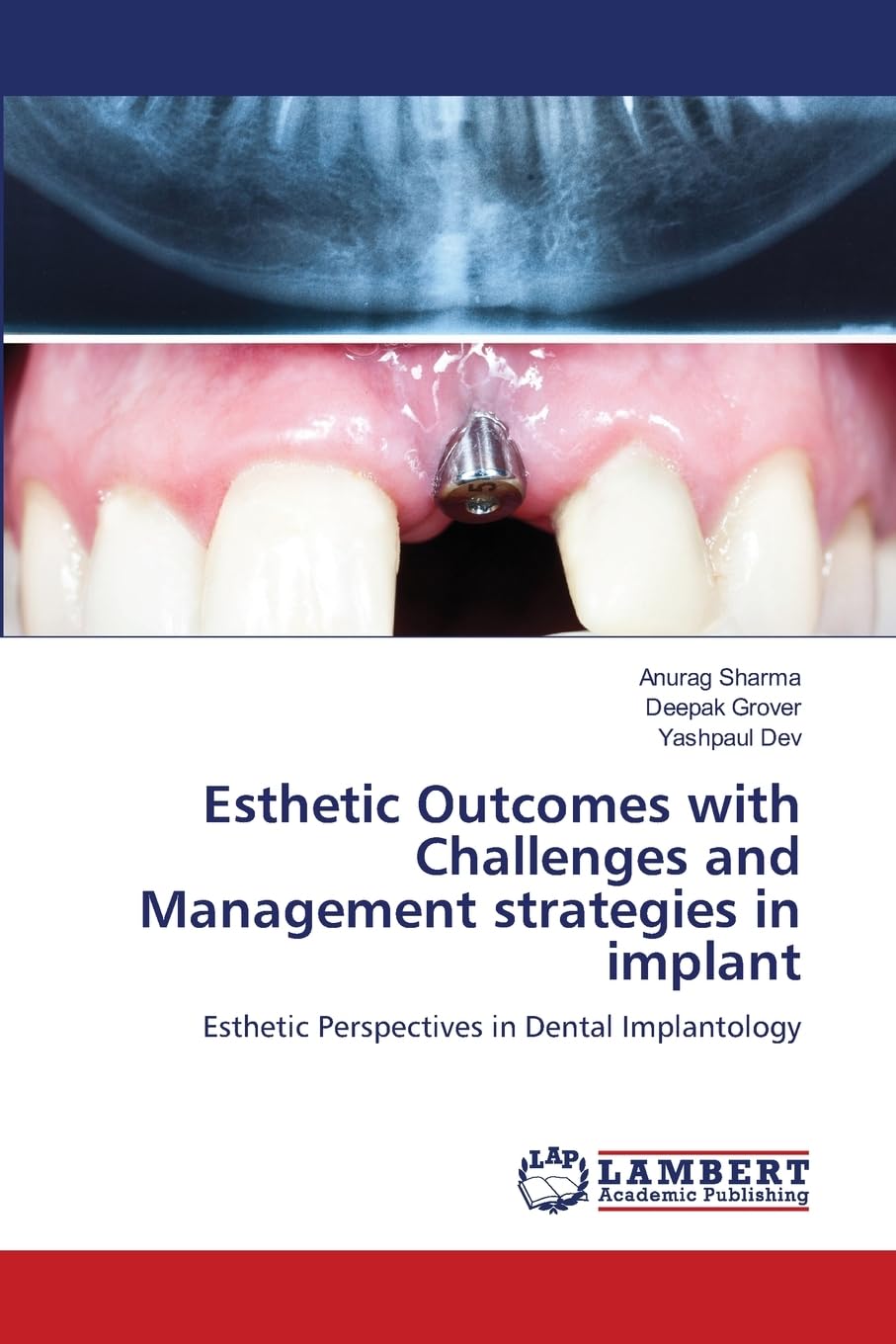 Esthetic Outcomes with Challenges and Management strategies in implant Medicine