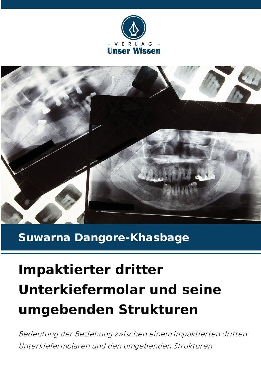Impaktierter dritter Unterkiefermolar und seine umgebenden Strukturen Medicine
