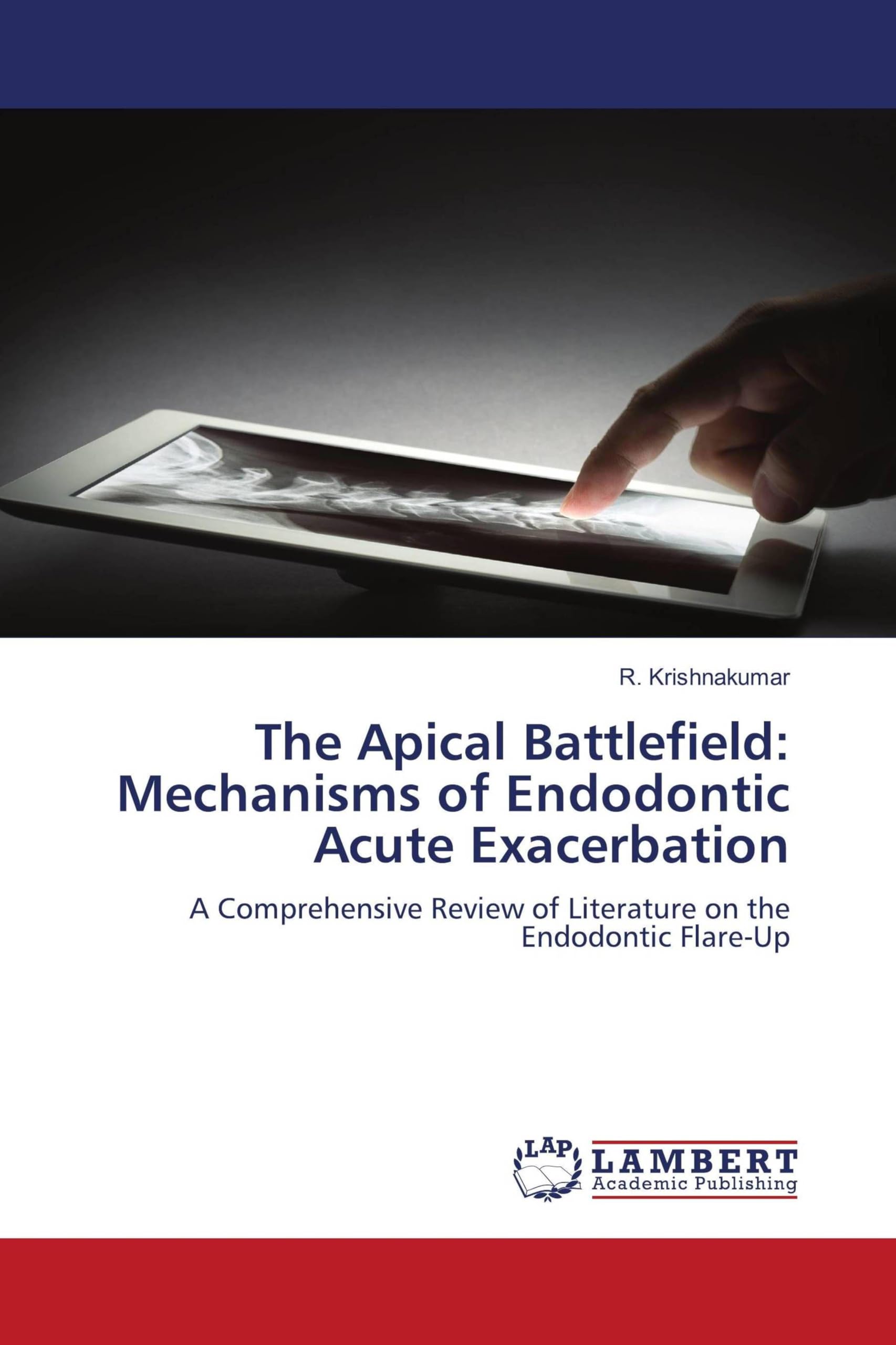 The Apical Battlefield: Mechanisms of Endodontic Acute Exacerbation Medicine