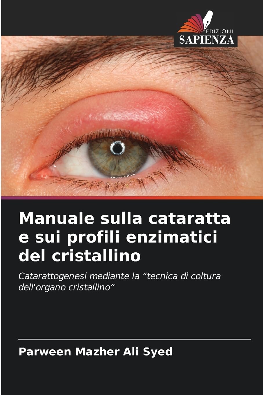 Manuale sulla cataratta e sui profili enzimatici del cristallino Natural Sciences