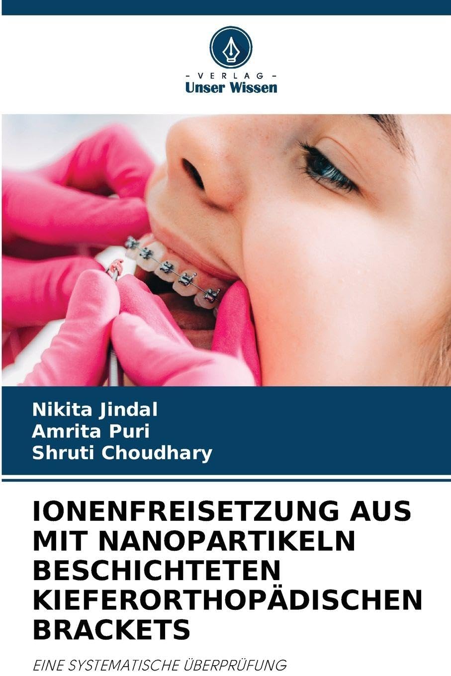 IONENFREISETZUNG AUS MIT NANOPARTIKELN BESCHICHTETEN KIEFERORTHOPÄDISCHEN BRACKETS Medicine
