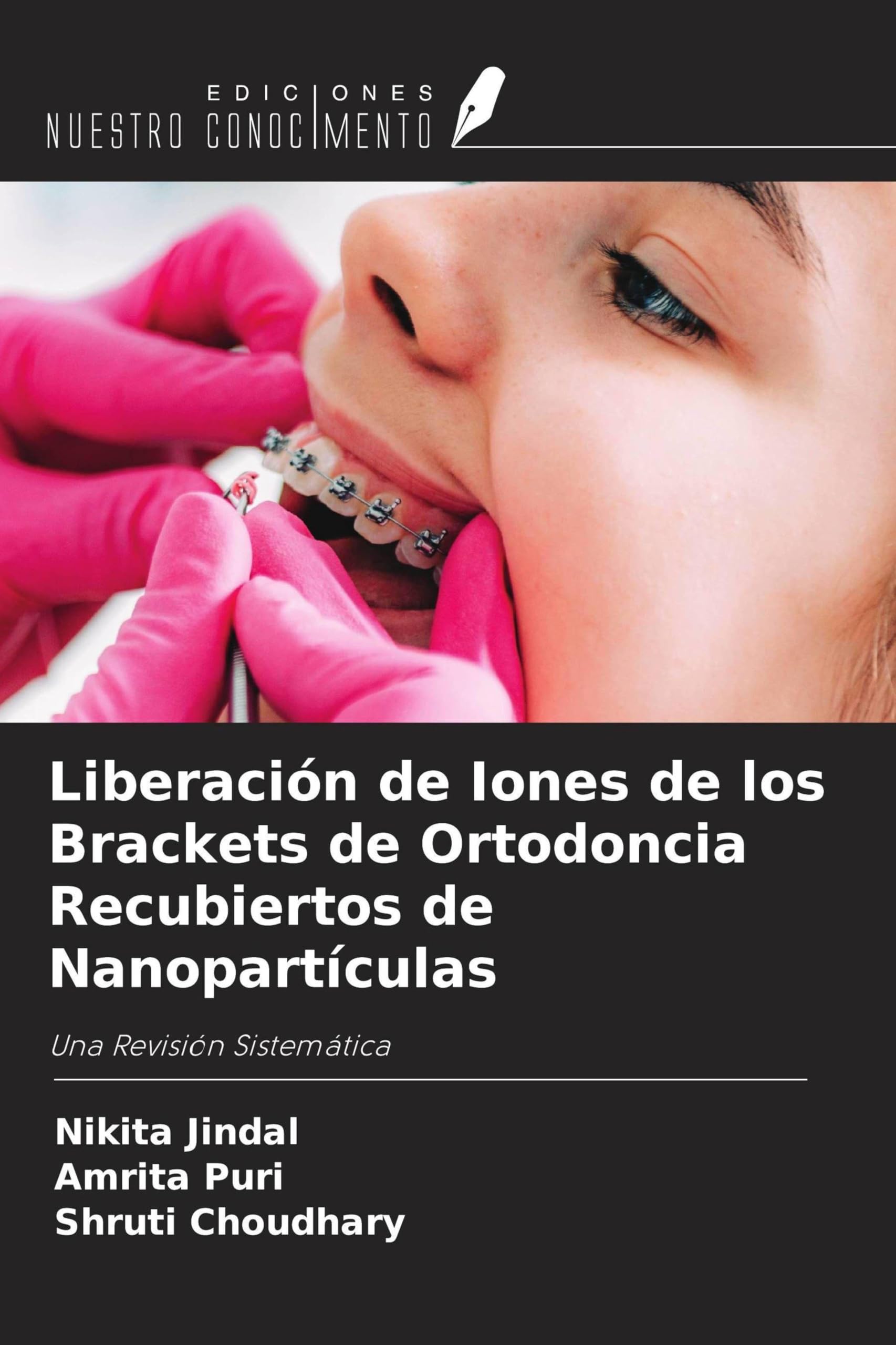 Liberación de Iones de los Brackets de Ortodoncia Recubiertos de Nanopartículas Medicine