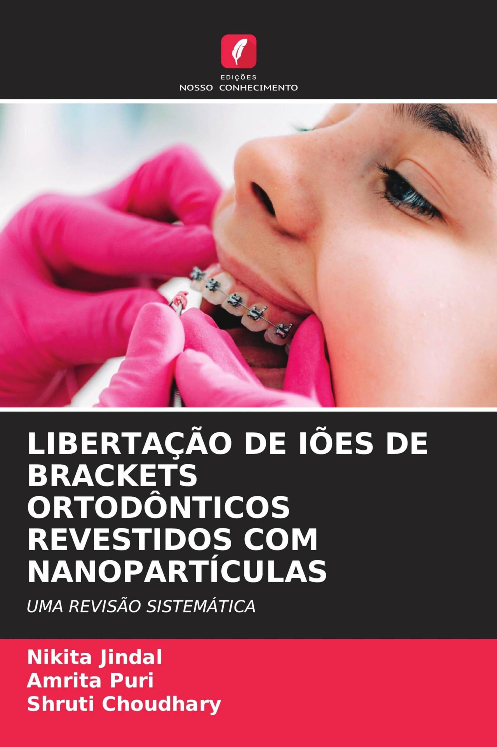 LIBERTAÇÃO DE IÕES DE BRACKETS ORTODÔNTICOS REVESTIDOS COM NANOPARTÍCULAS Medicine