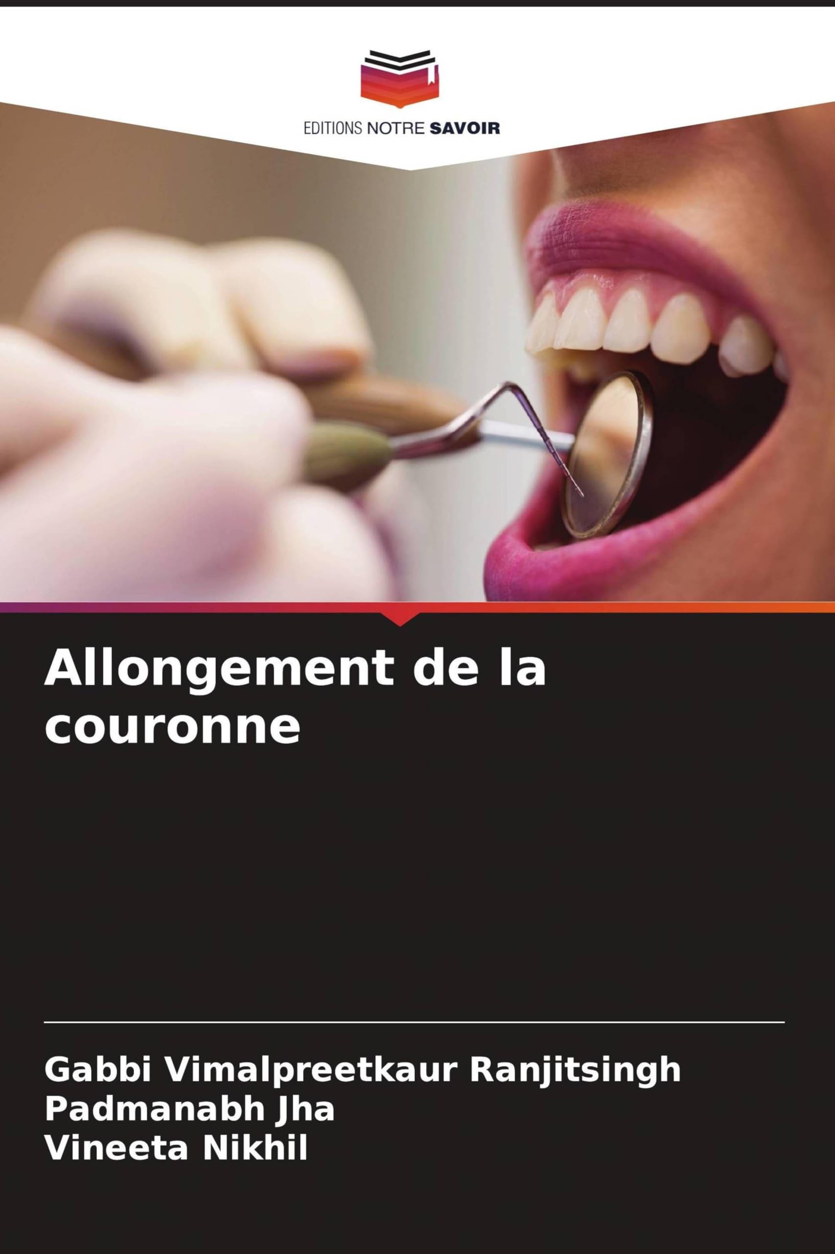 Allongement de la couronne Books