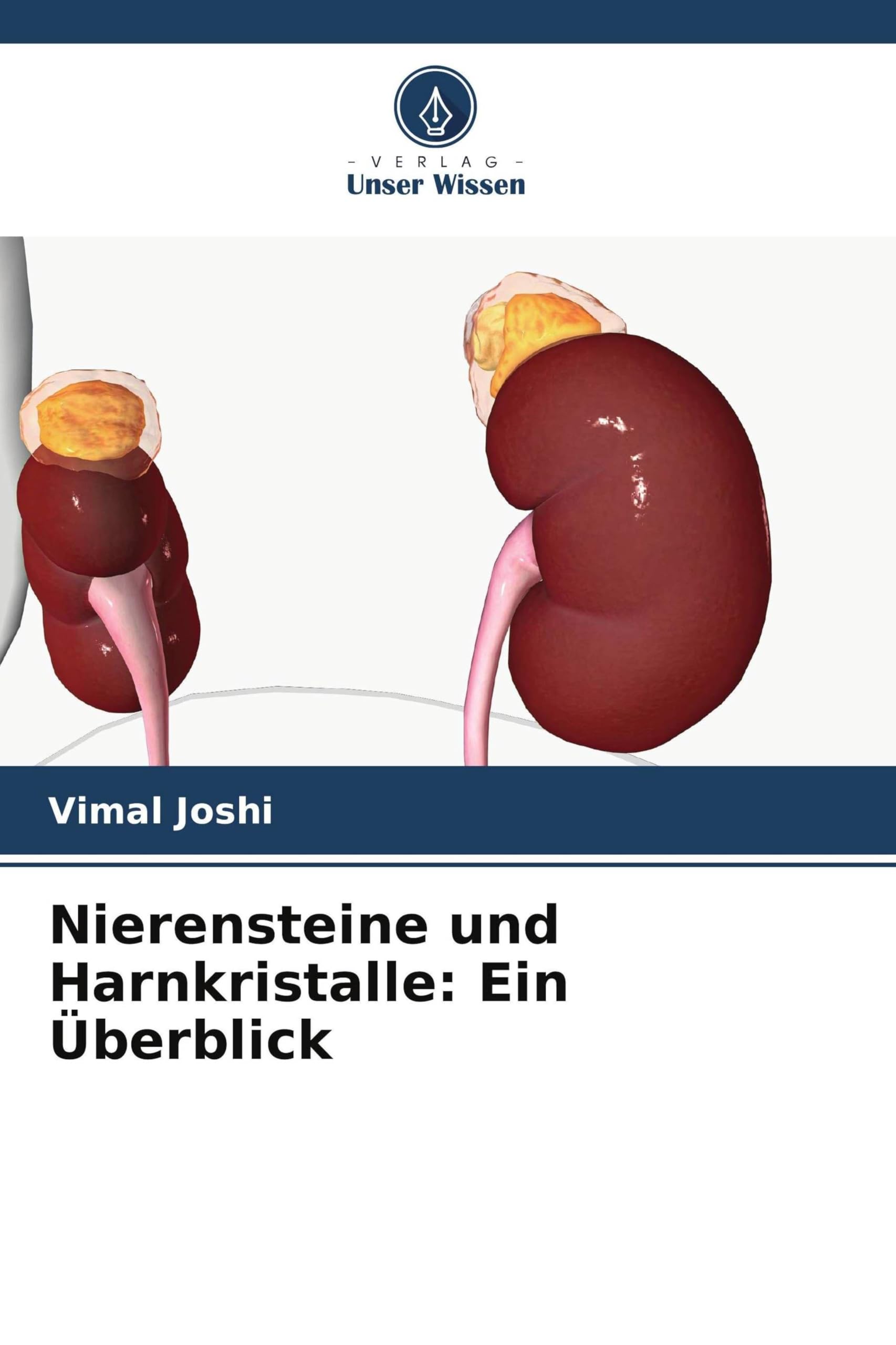 Nierensteine und Harnkristalle: Ein Überblick Medicine