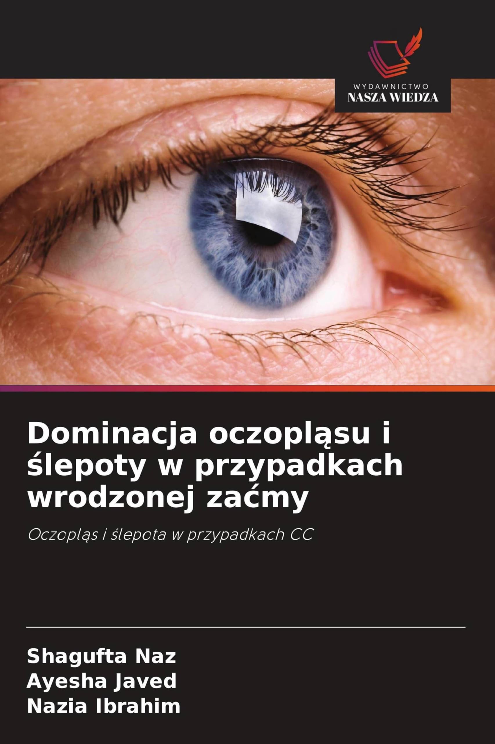 Dominacja oczopl¿su i ¿lepoty w przypadkach wrodzonej za¿my Natural Sciences